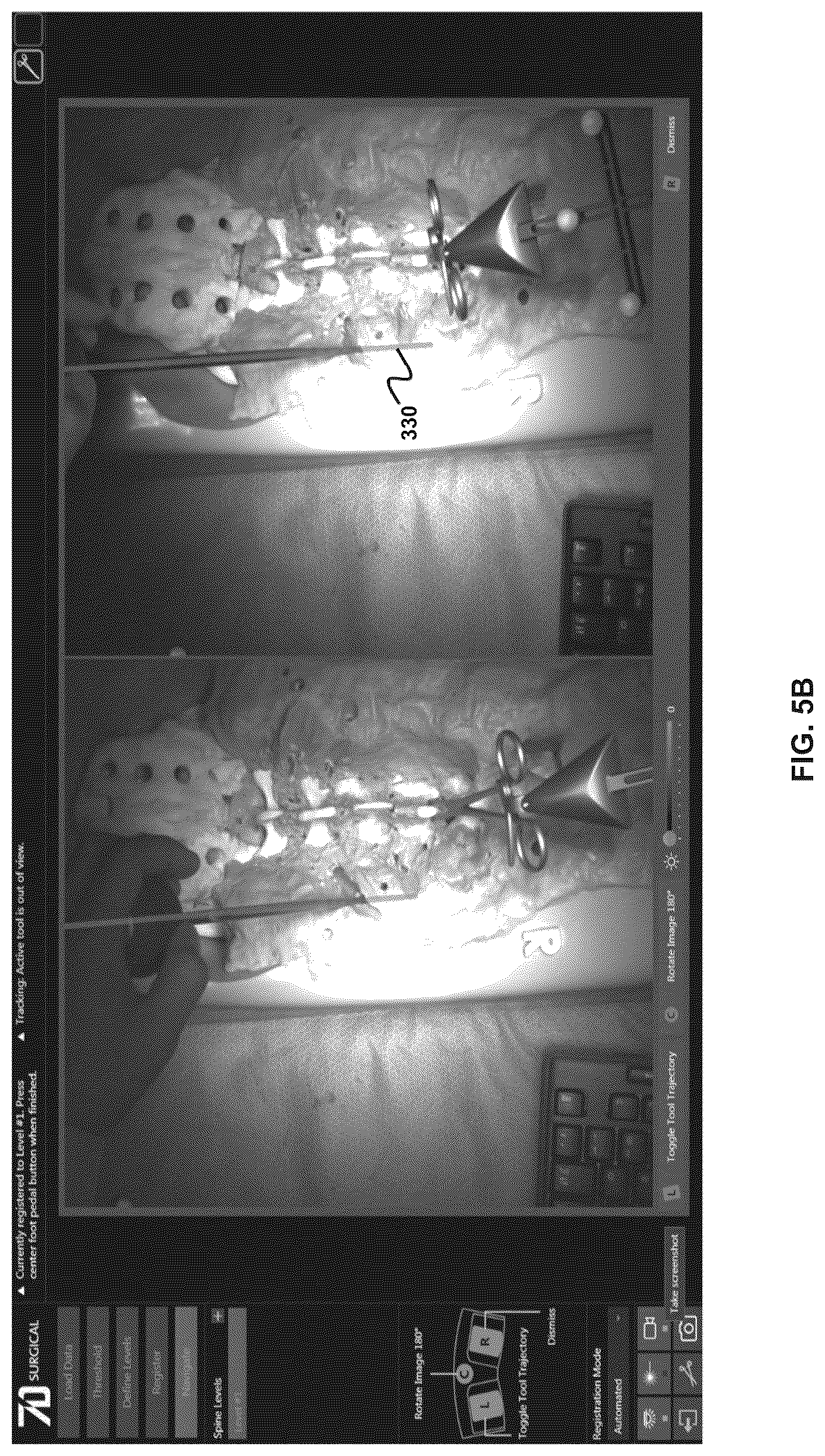 Patent US12396803 Figure 9 – Systems and methods for performing intraoperative guidance