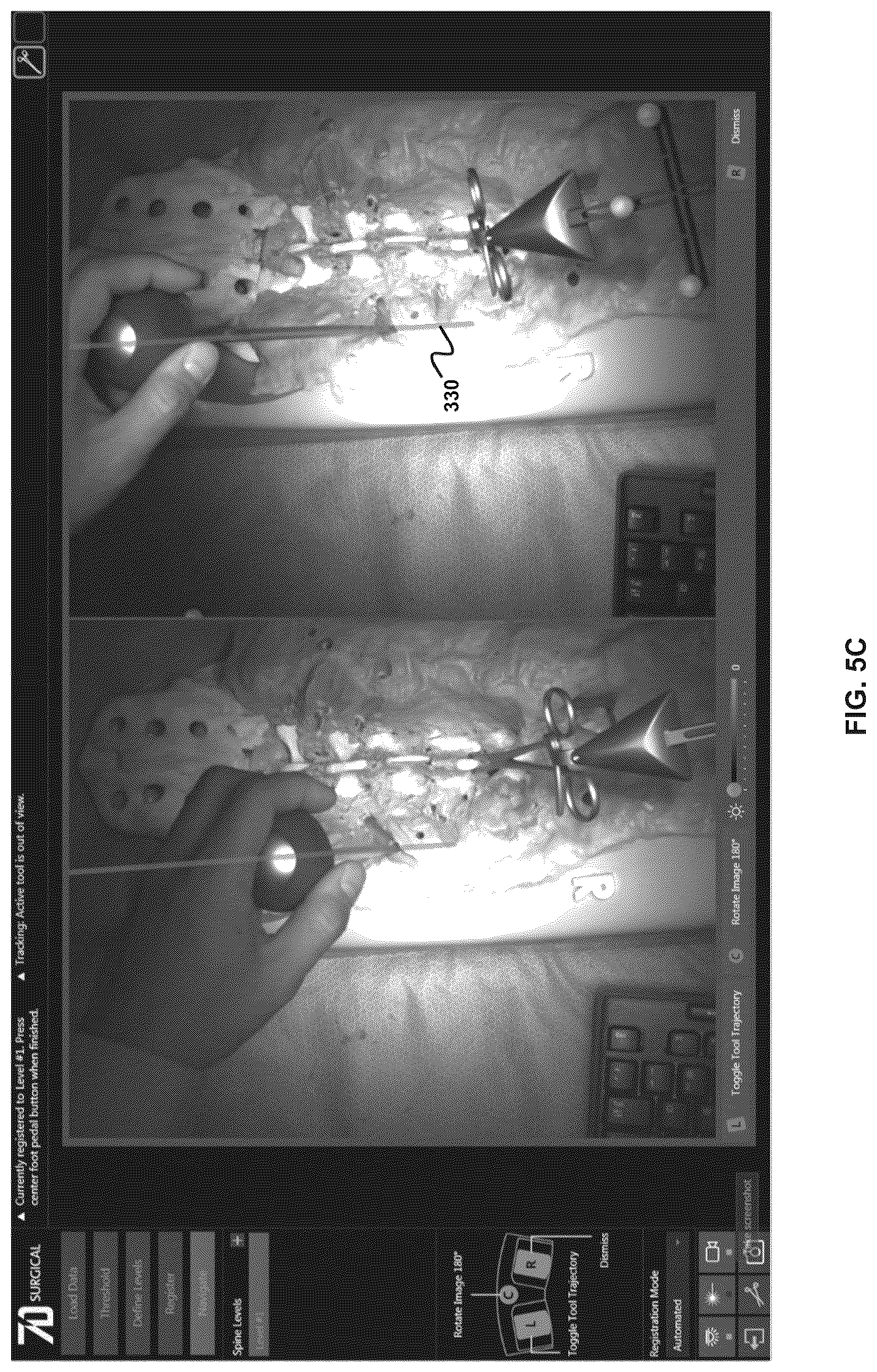 Patent US12396803 Figure 10 – Systems and methods for performing intraoperative guidance