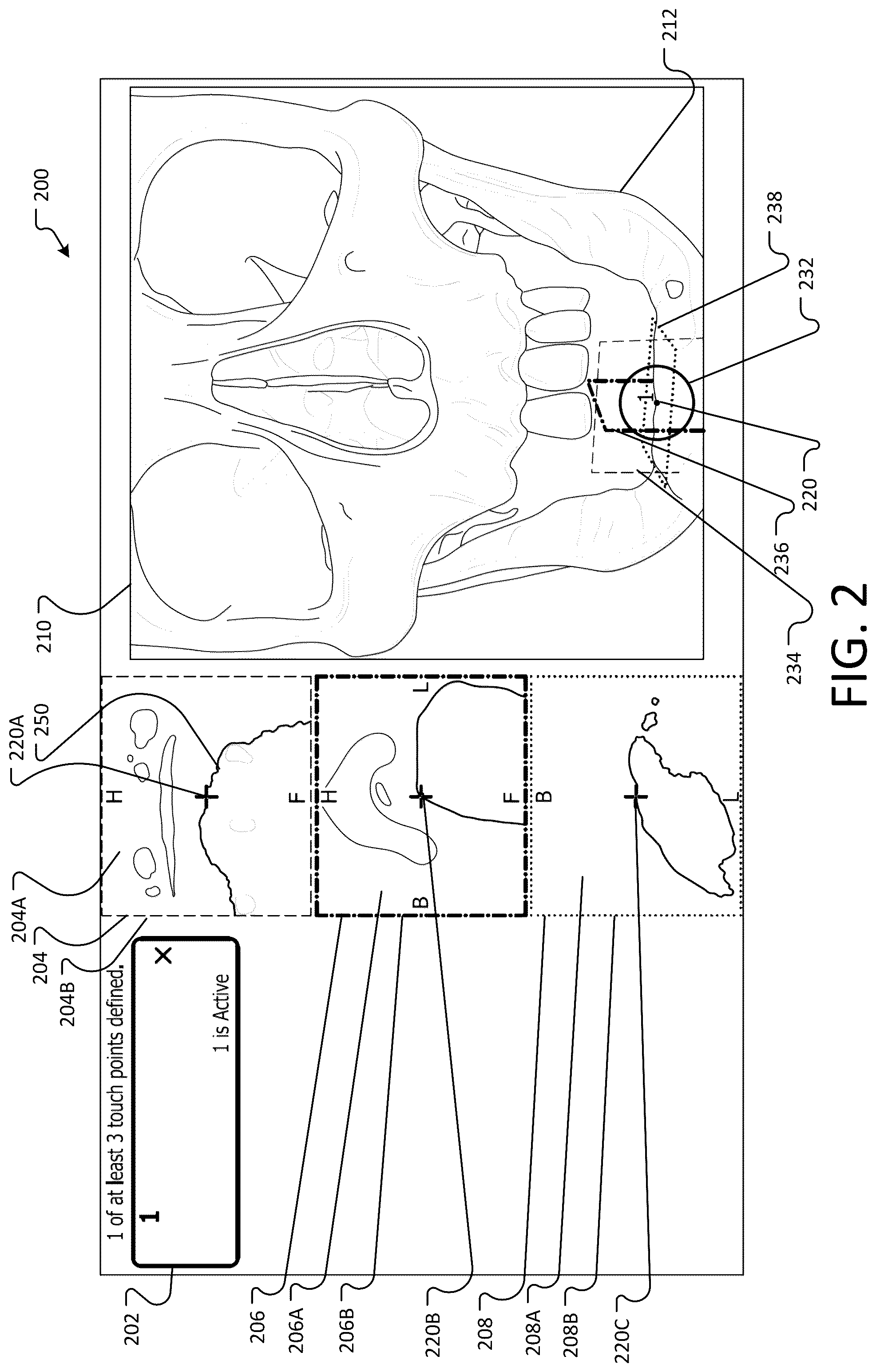 Patent US12396804 Figure 2 – Landmark registration system for image-guided navigation