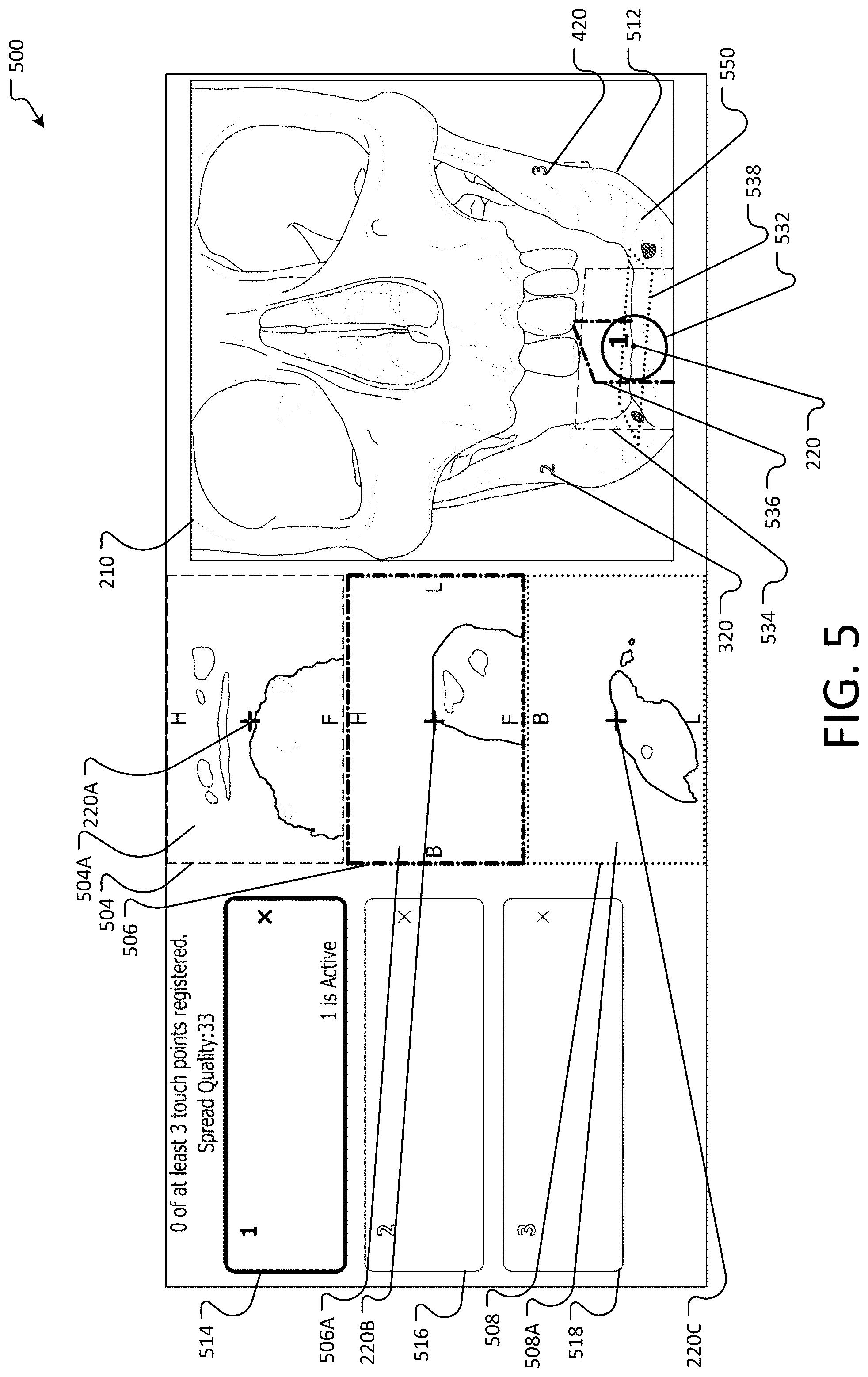 Patent US12396804 Figure 5 – Landmark registration system for image-guided navigation