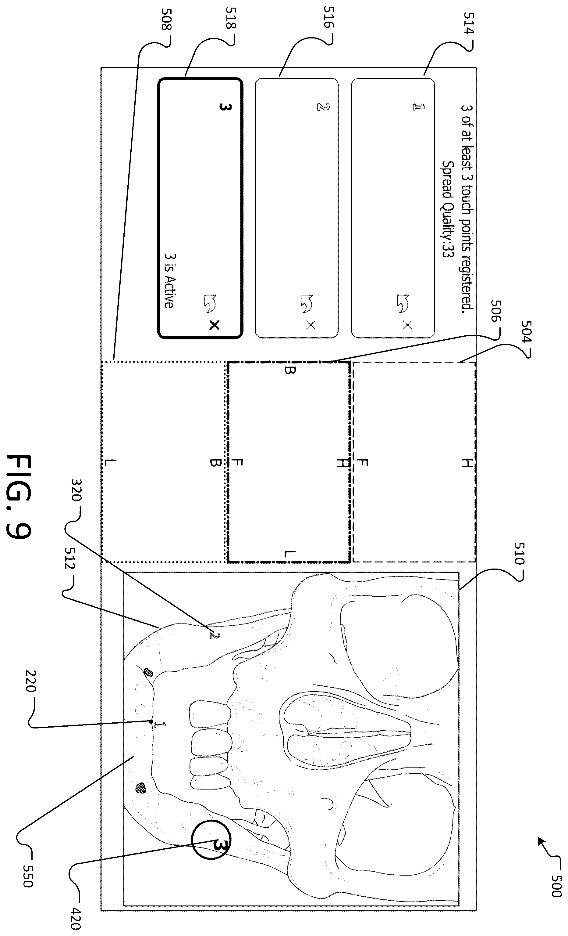 Patent US12396804 Figure 9 – Landmark registration system for image-guided navigation