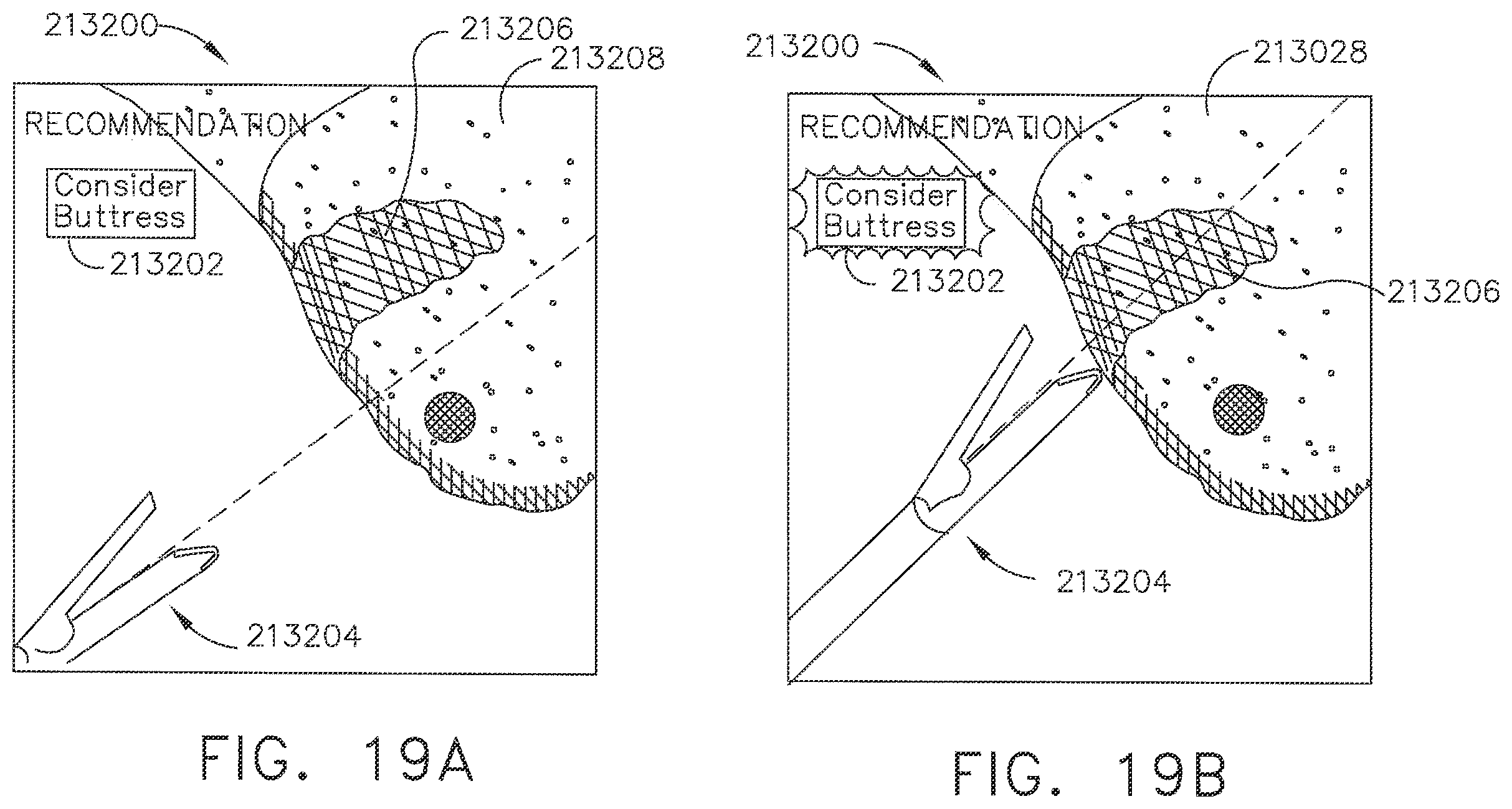 Patent US12396806 Figure 18 – Adjustment of a surgical device function based on situational awareness