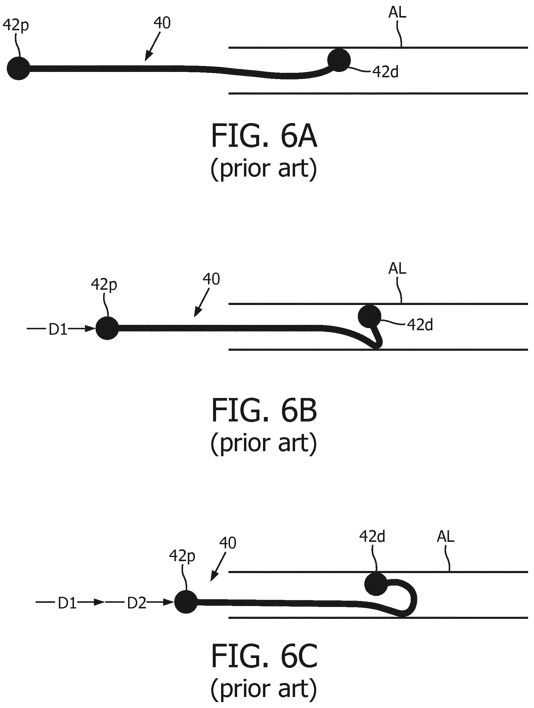 Patent US12396807 Figure 5 – OSS guiding and monitoring systems, controllers and methods