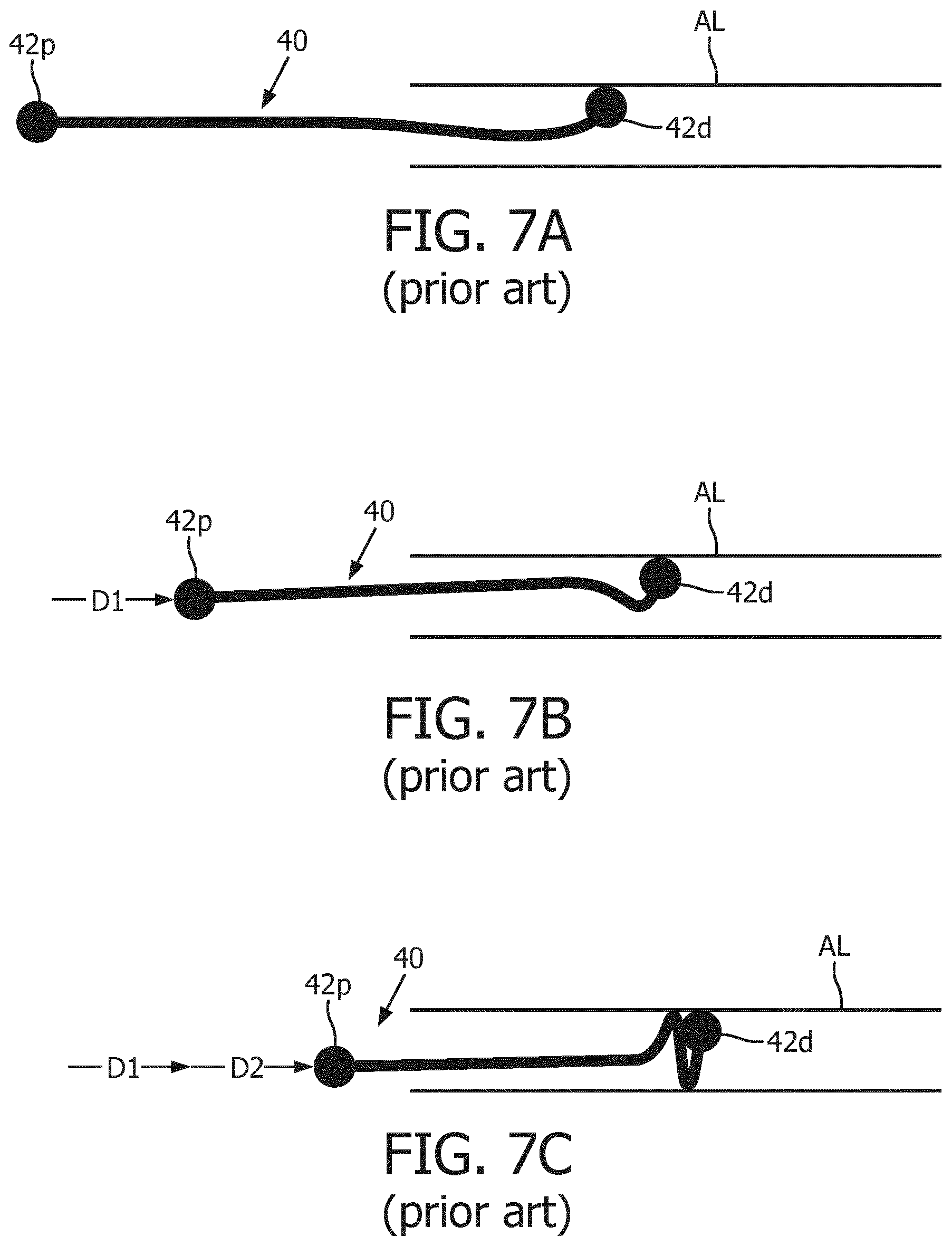 Patent US12396807 Figure 6 – OSS guiding and monitoring systems, controllers and methods