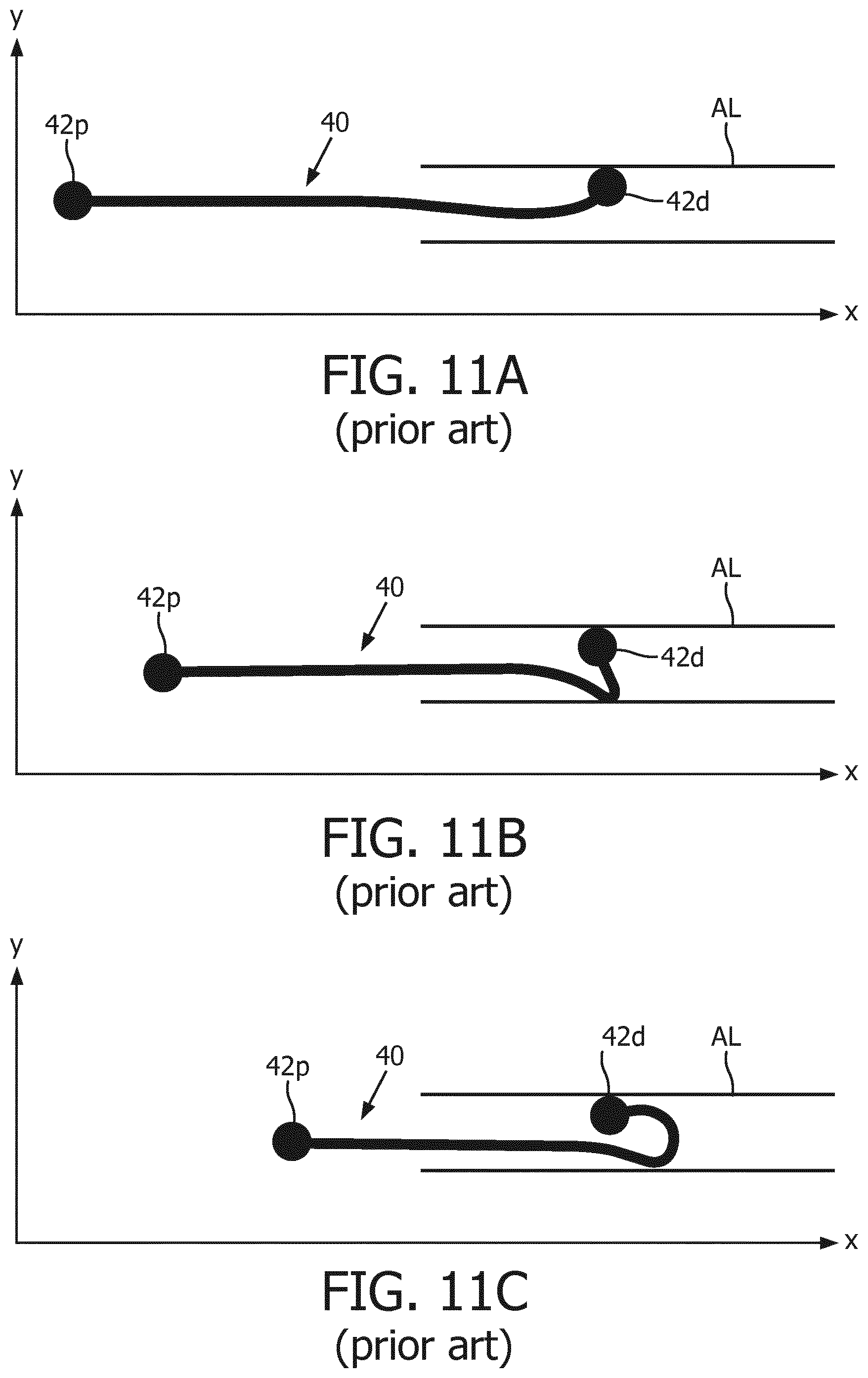Patent US12396807 Figure 10 – OSS guiding and monitoring systems, controllers and methods