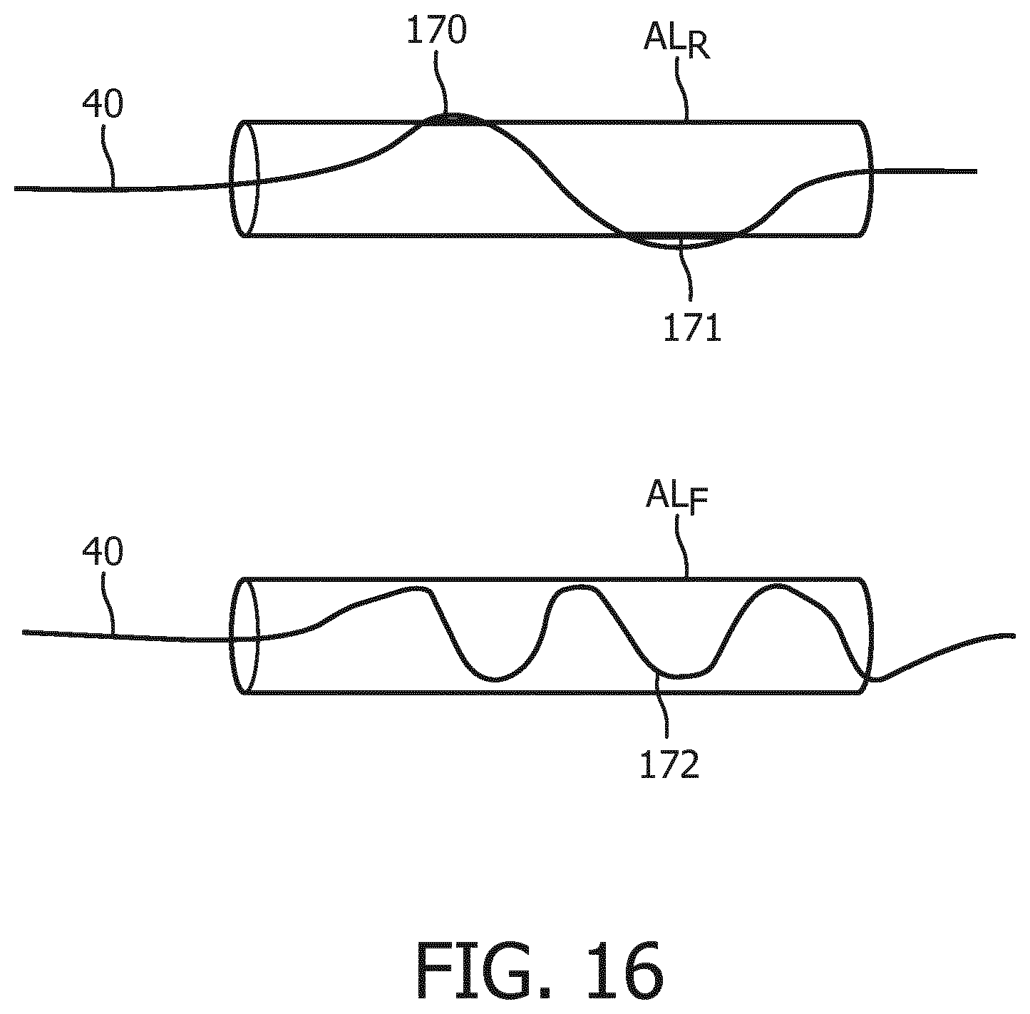 Patent US12396807 Figure 16 – OSS guiding and monitoring systems, controllers and methods