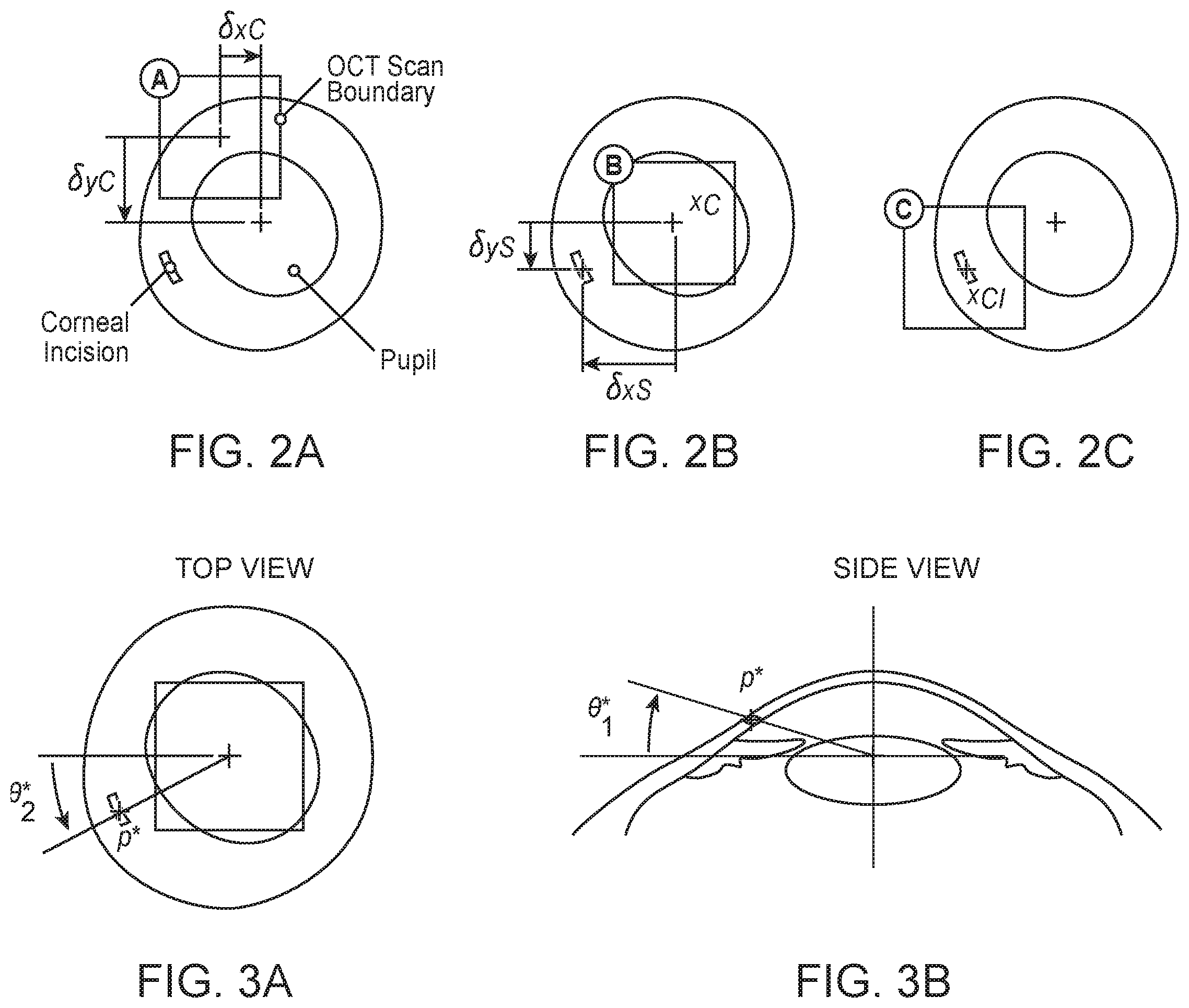Patent US12396810 Figure 4 – System and method for automated image-guided robotic intraocular surgery