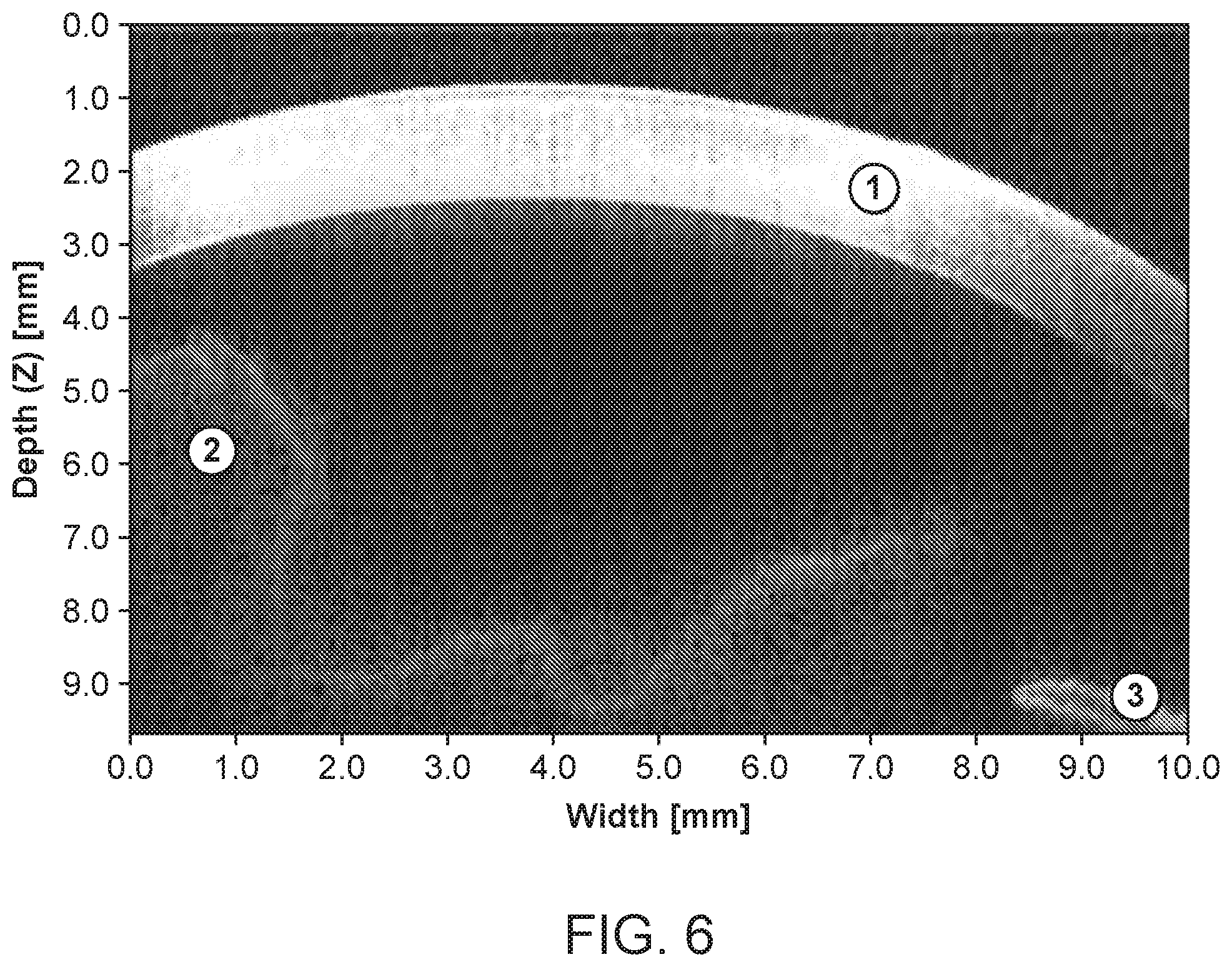 Patent US12396810 Figure 6 – System and method for automated image-guided robotic intraocular surgery