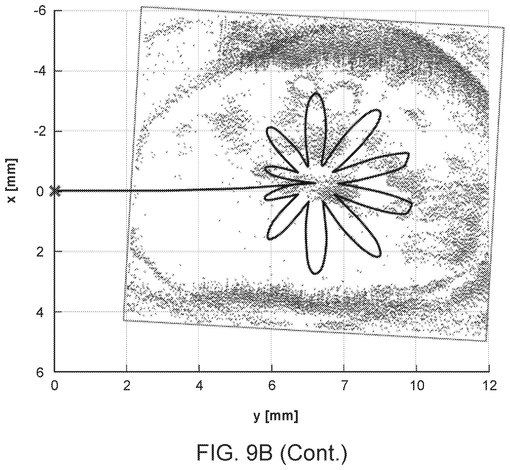 Patent US12396810 Figure 10 – System and method for automated image-guided robotic intraocular surgery