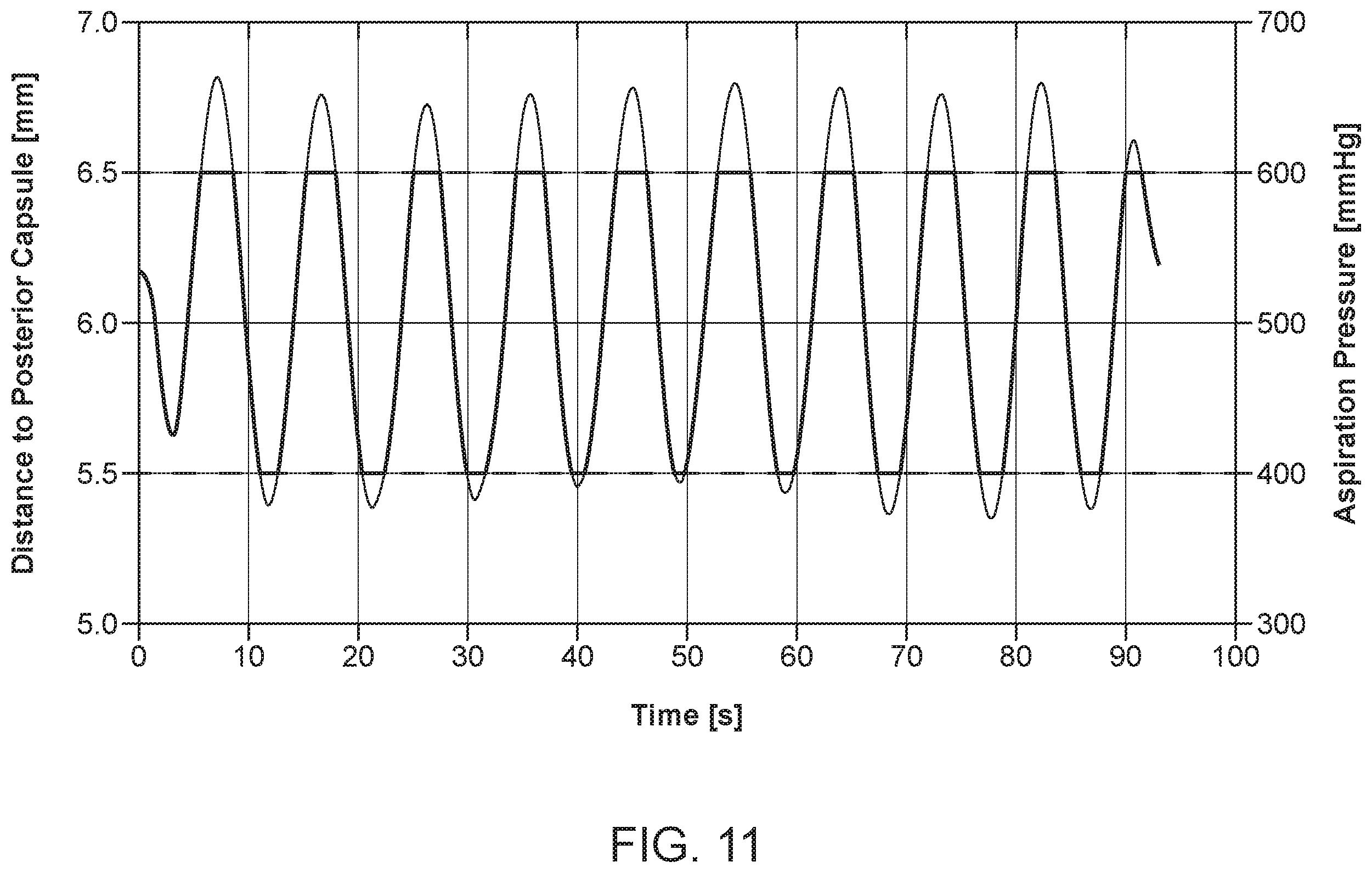 Patent US12396810 Figure 12 – System and method for automated image-guided robotic intraocular surgery