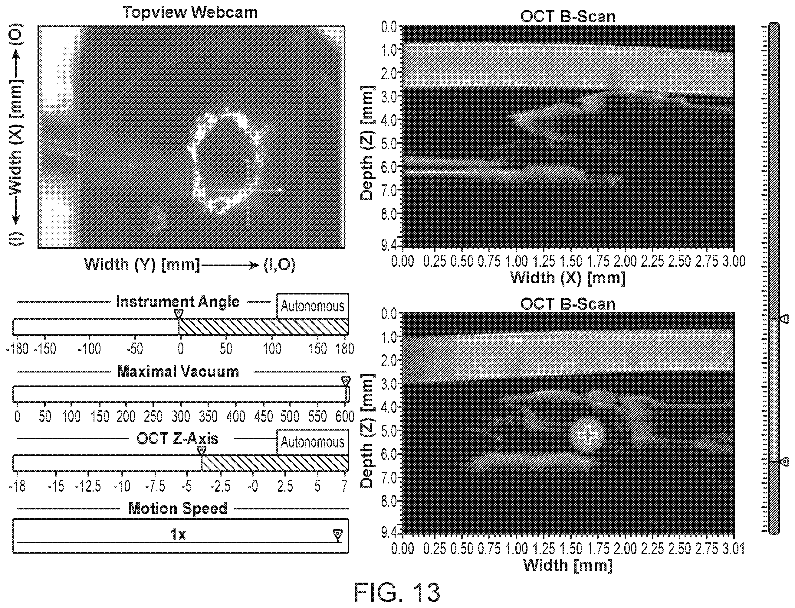 Patent US12396810 Figure 14 – System and method for automated image-guided robotic intraocular surgery
