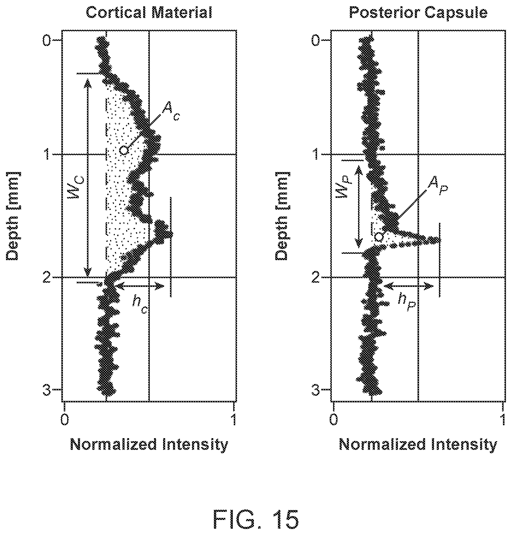 Patent US12396810 Figure 16 – System and method for automated image-guided robotic intraocular surgery
