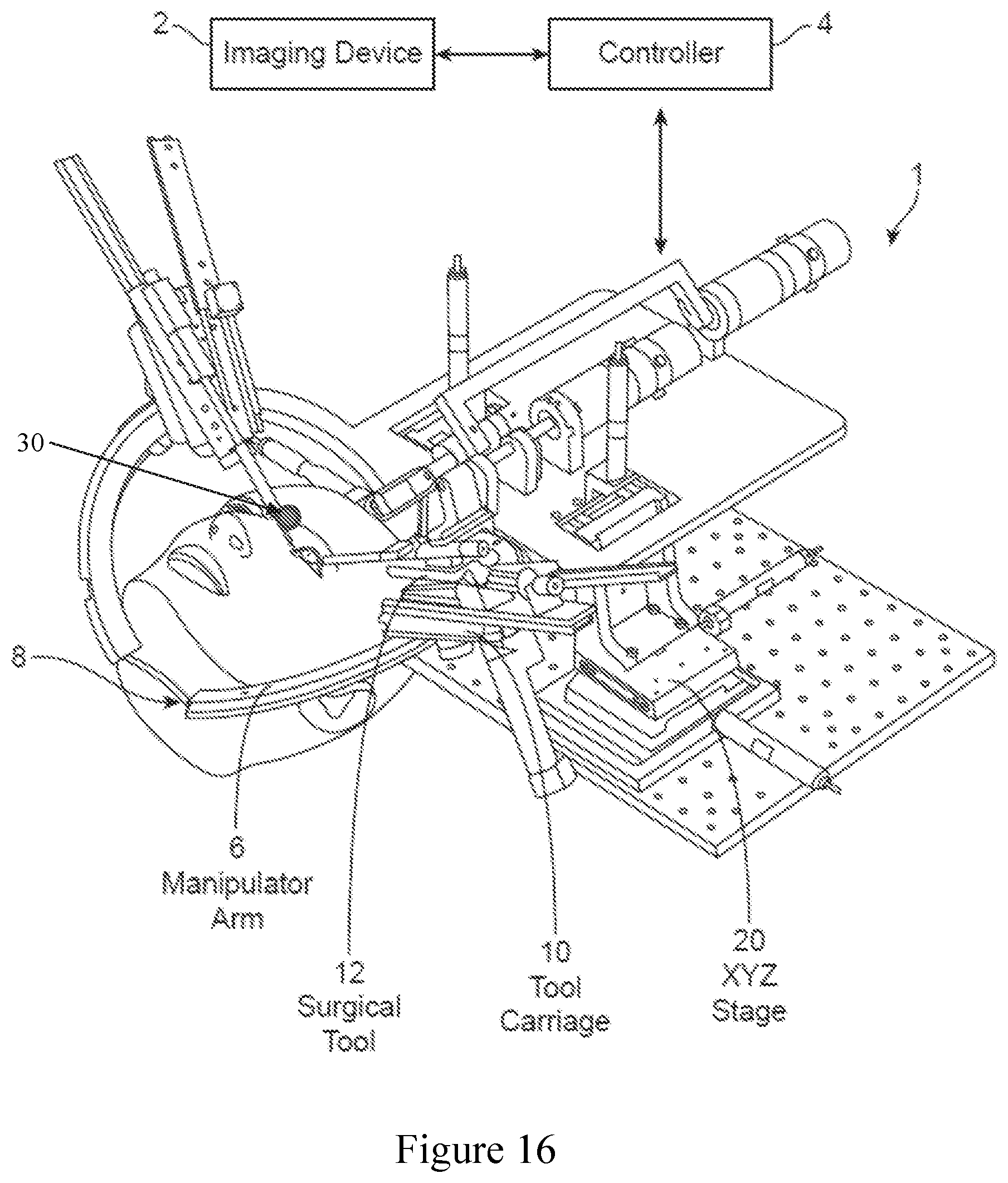 Patent US12396810 Figure 17 – System and method for automated image-guided robotic intraocular surgery