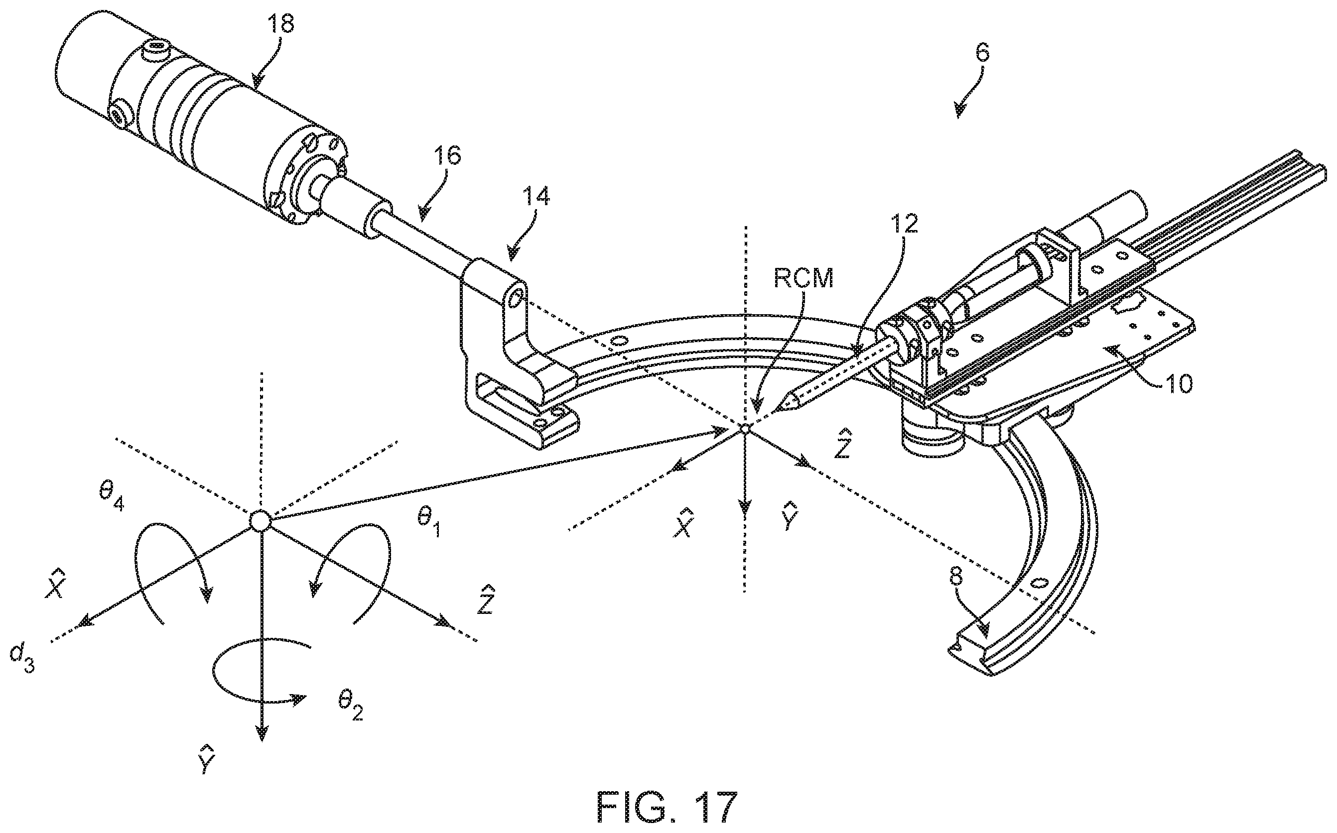 Patent US12396810 Figure 18 – System and method for automated image-guided robotic intraocular surgery