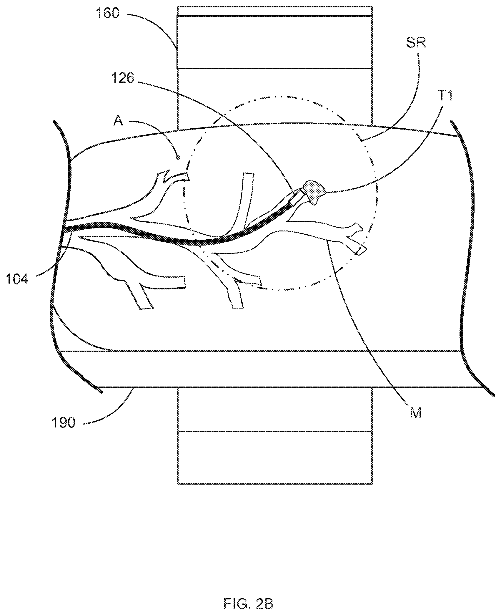 Patent US12396812 Figure 4 – Systems and methods for robotic medical system integration with external imaging