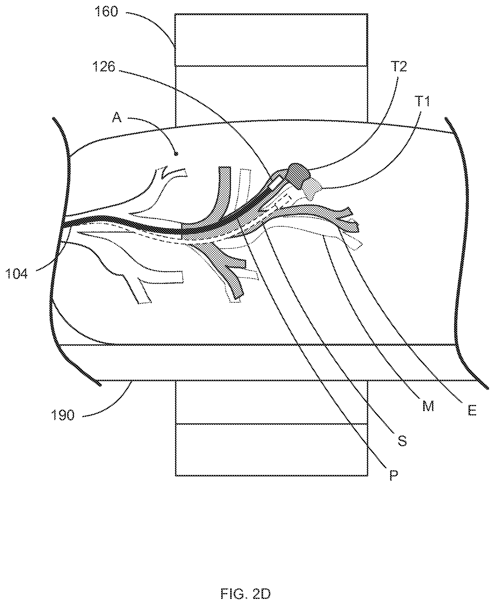 Patent US12396812 Figure 6 – Systems and methods for robotic medical system integration with external imaging