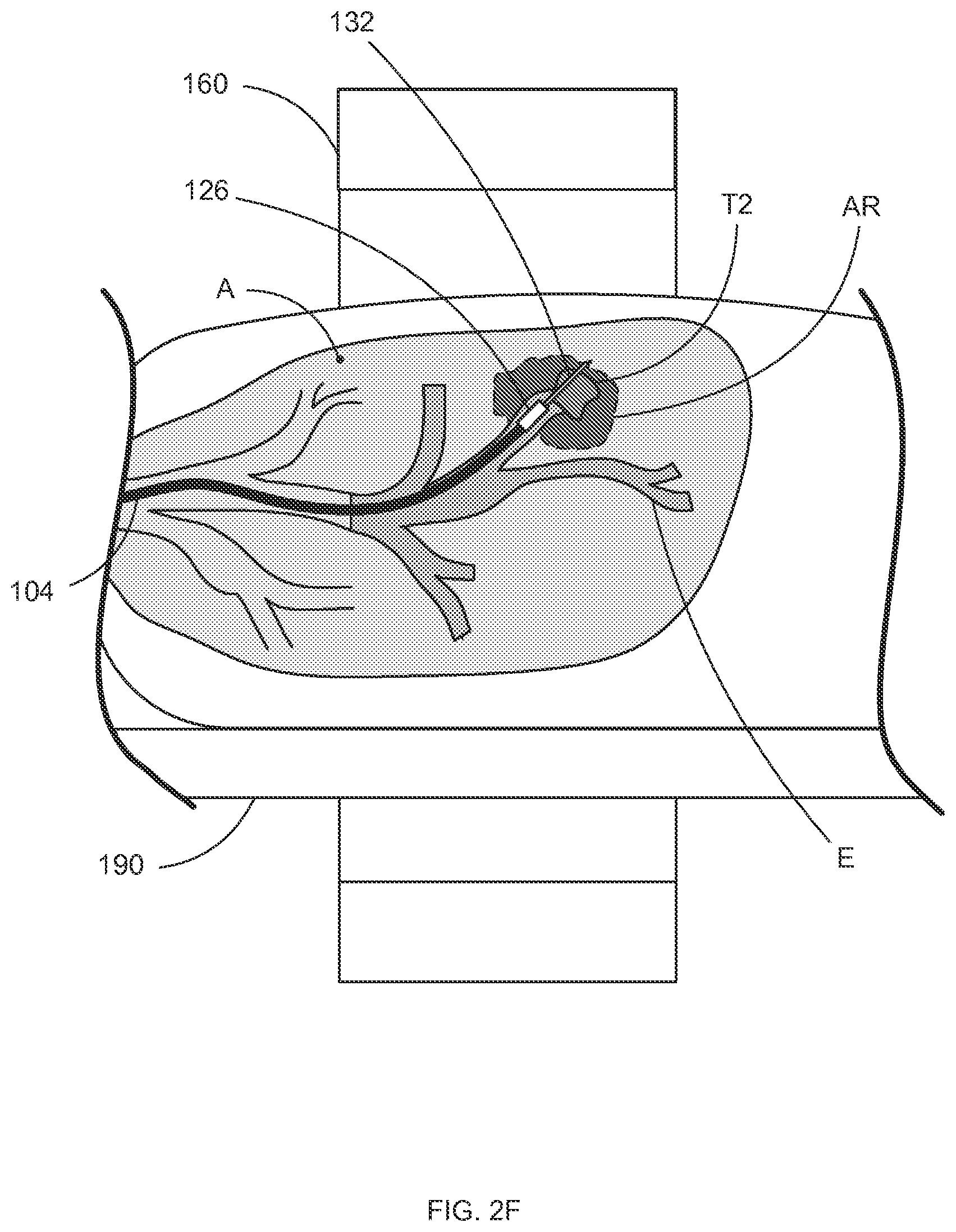 Patent US12396812 Figure 8 – Systems and methods for robotic medical system integration with external imaging