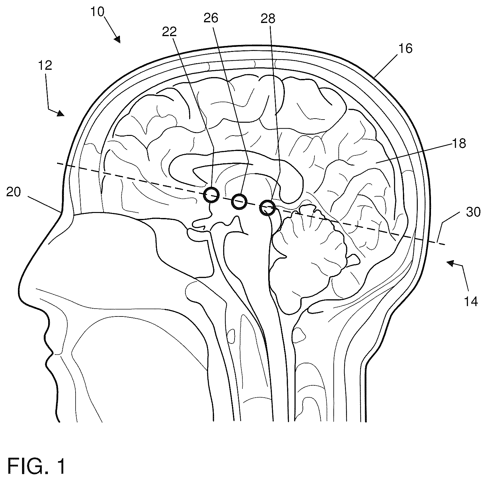 Patent US12396821 Figure 1 – Devices for assisting neurosurgical interventions