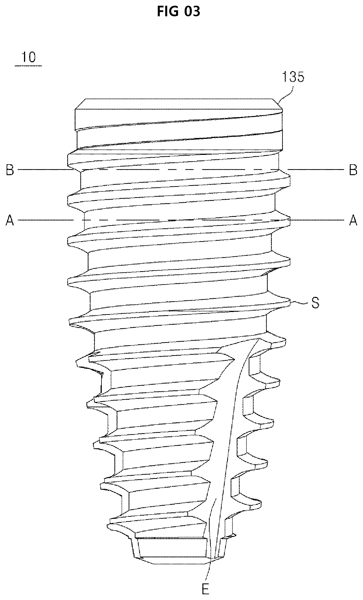 Patent US12396825 Figure 3 – Fixture of dental implant