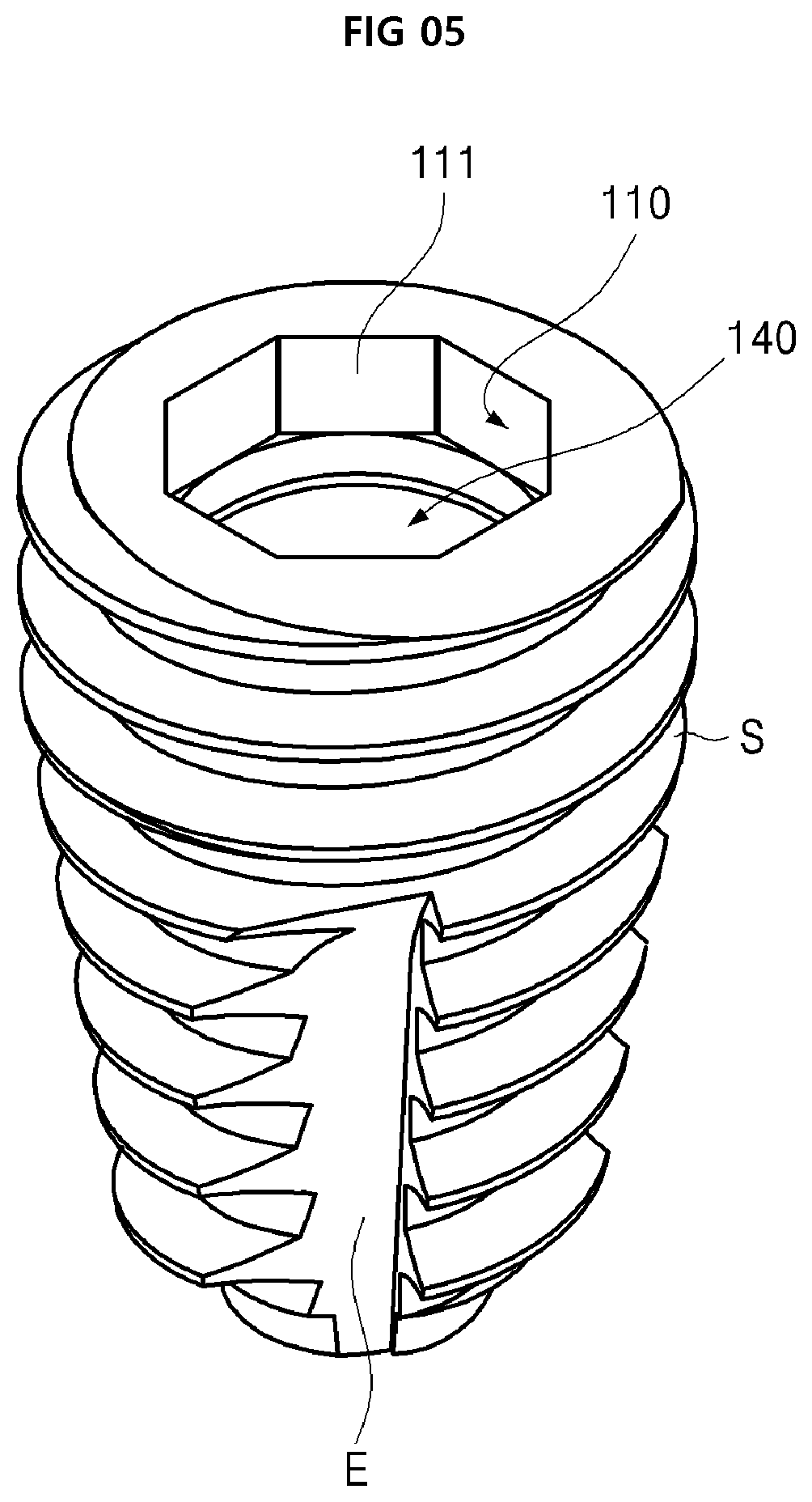 Patent US12396825 Figure 5 – Fixture of dental implant