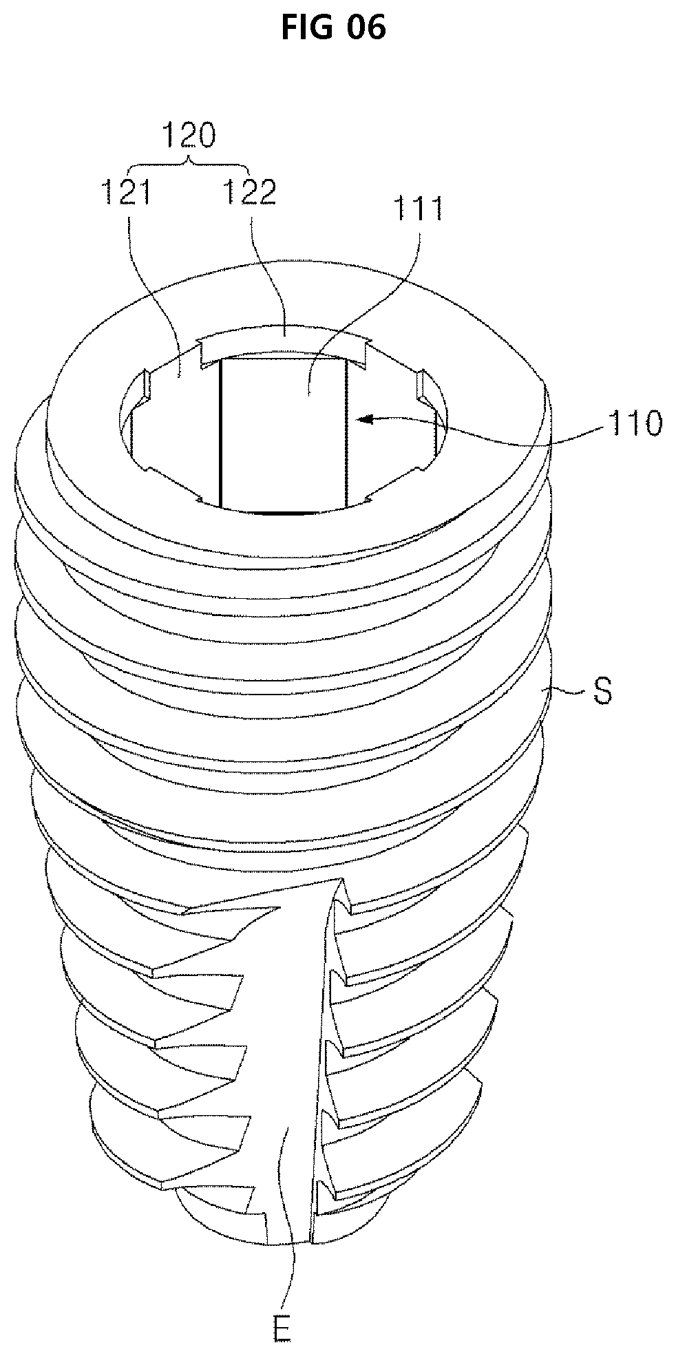 Patent US12396825 Figure 6 – Fixture of dental implant
