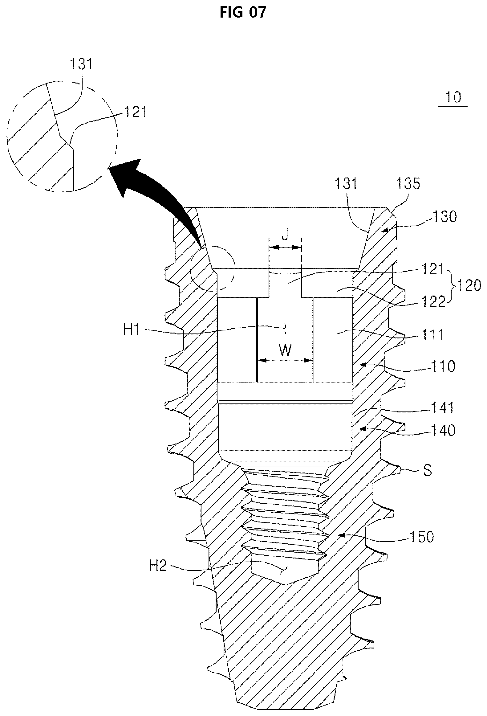 Patent US12396825 Figure 7 – Fixture of dental implant