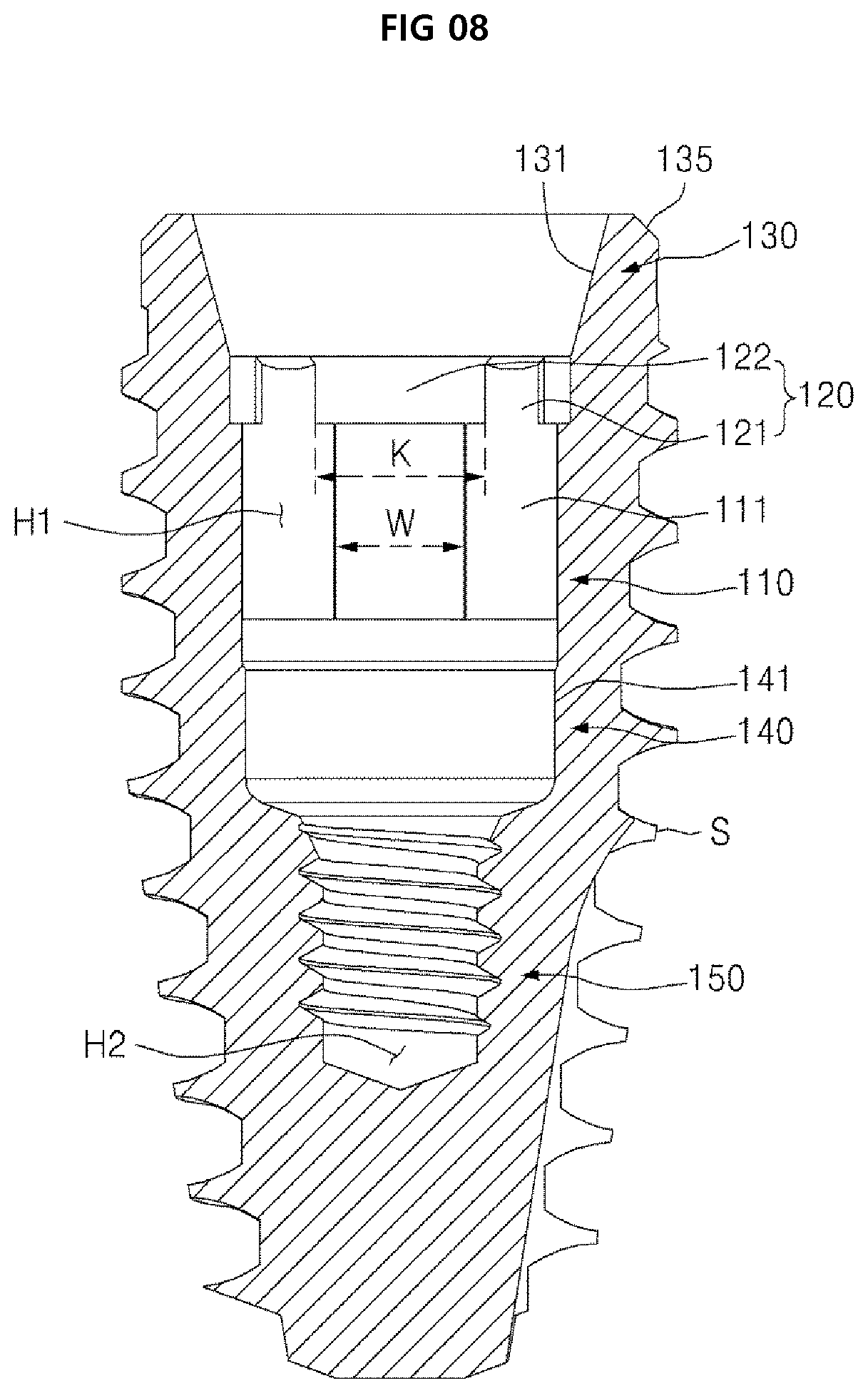 Patent US12396825 Figure 8 – Fixture of dental implant