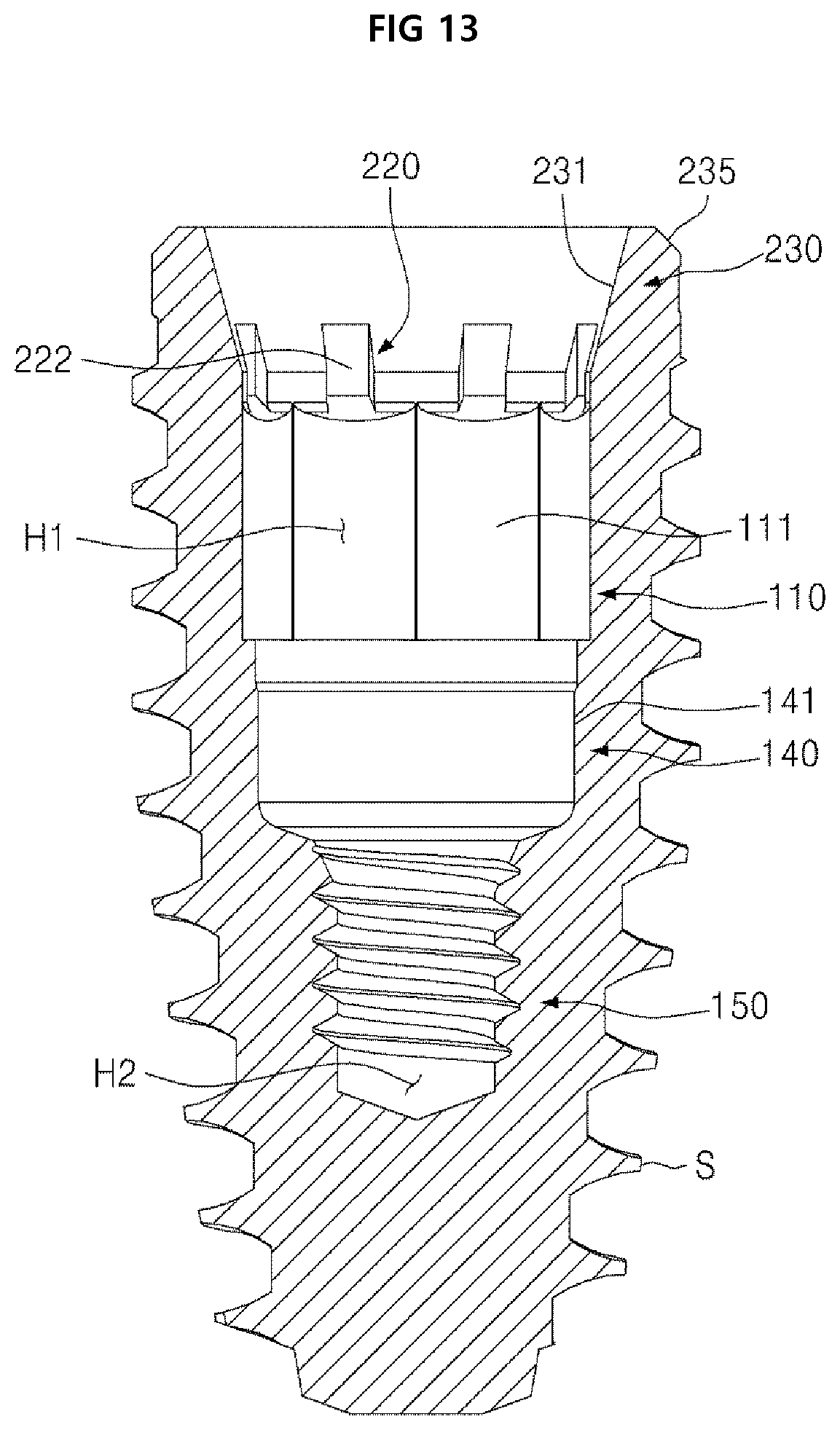 Patent US12396825 Figure 13 – Fixture of dental implant