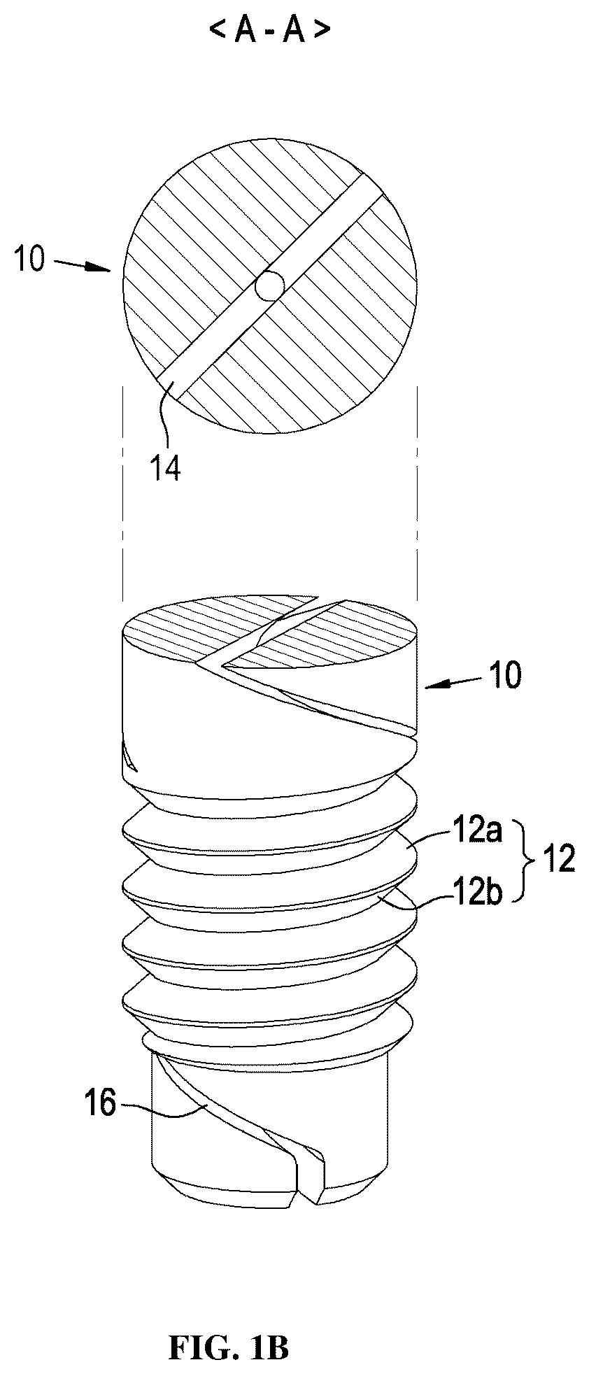 Patent US12396826 Figure 2 – Dental implant abutment having occlusal force buffering function