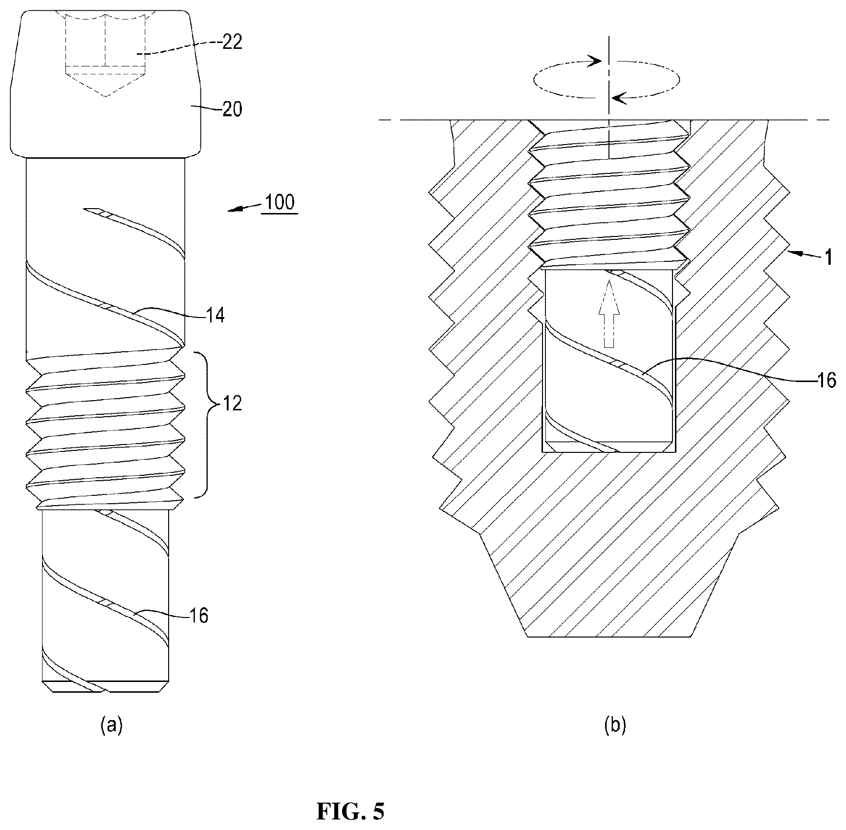 Patent US12396826 Figure 9 – Dental implant abutment having occlusal force buffering function