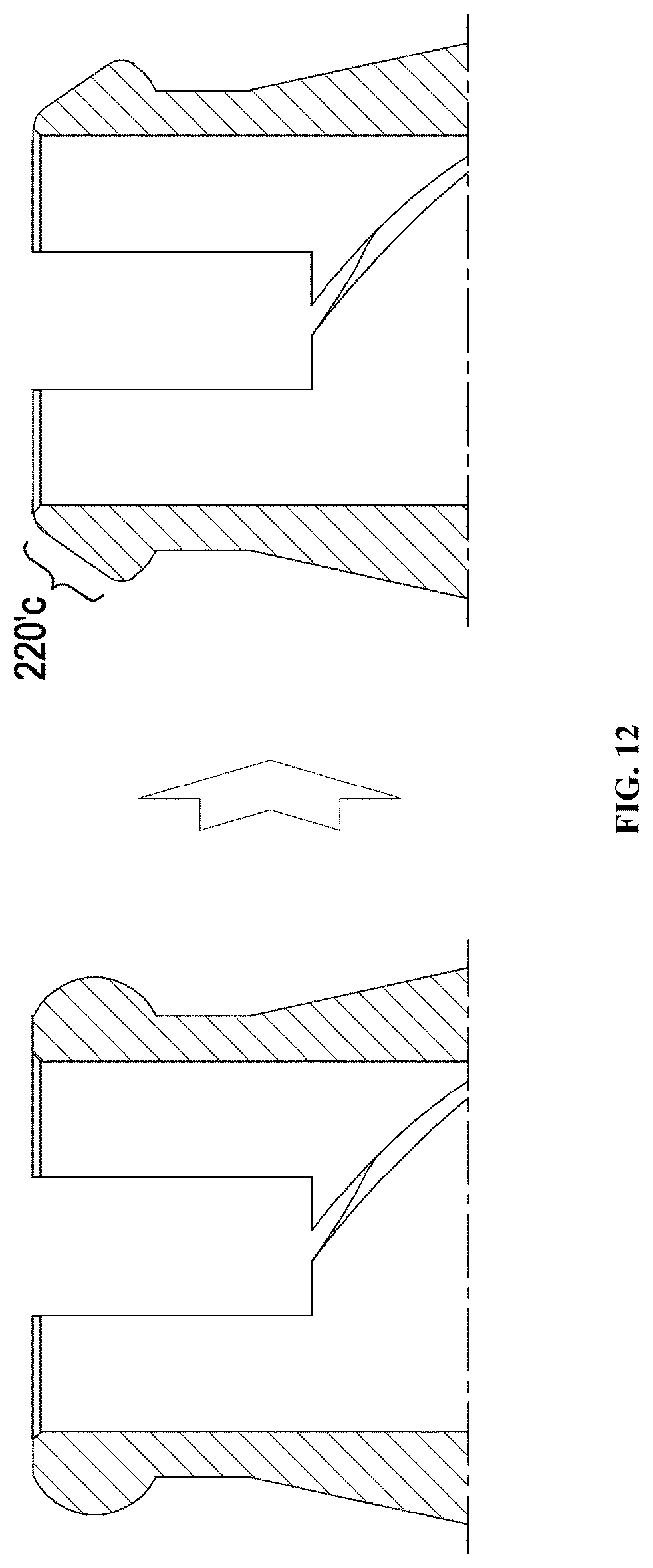 Patent US12396826 Figure 16 – Dental implant abutment having occlusal force buffering function