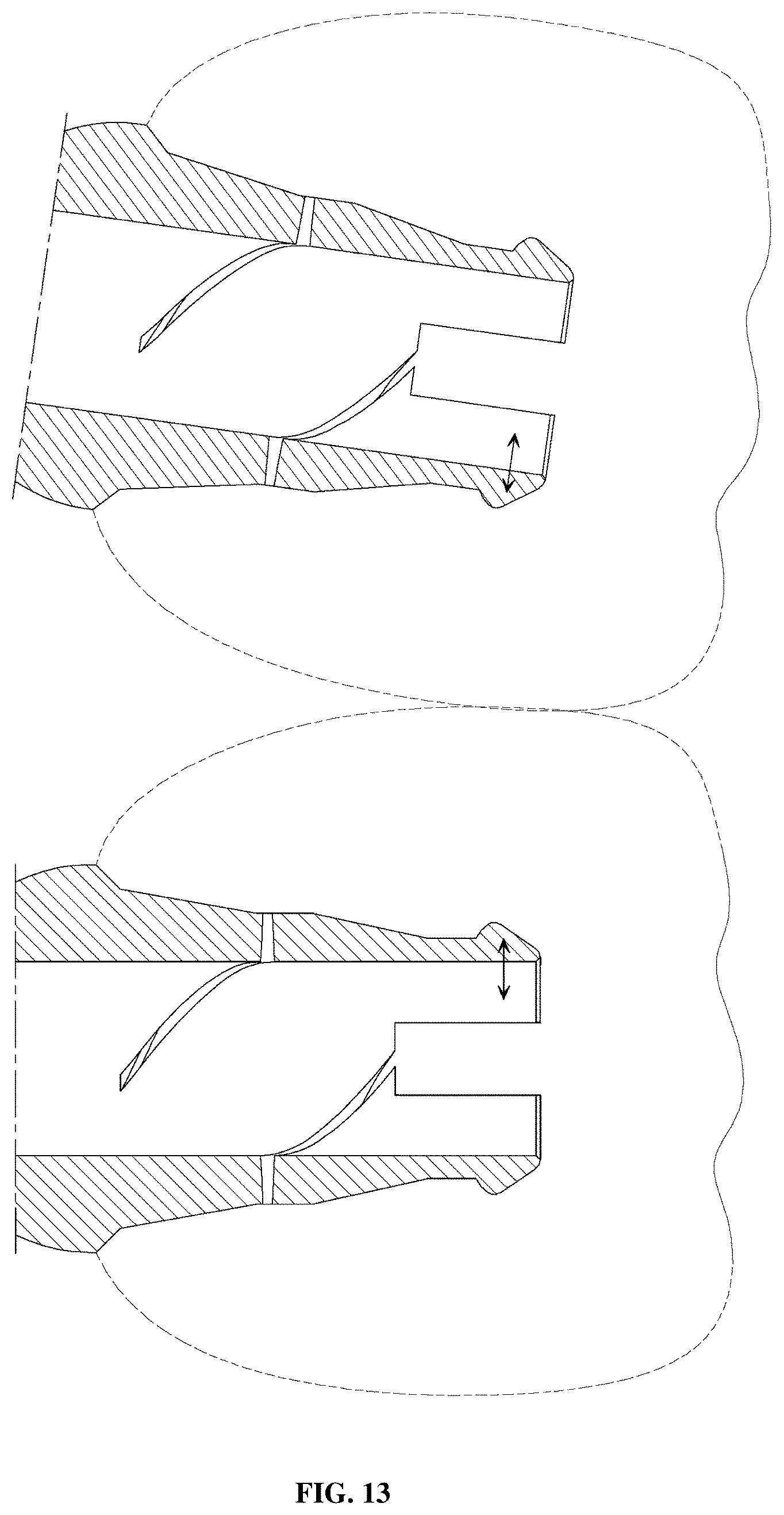 Patent US12396826 Figure 17 – Dental implant abutment having occlusal force buffering function