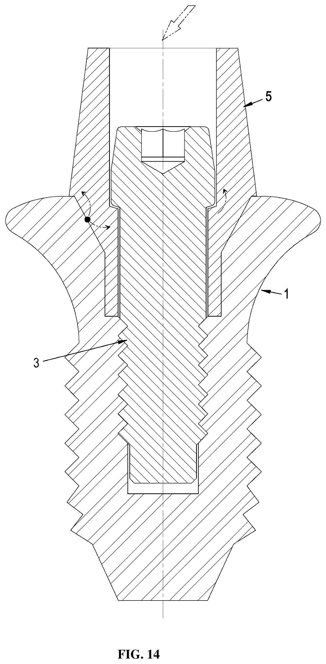 Patent US12396826 Figure 18 – Dental implant abutment having occlusal force buffering function