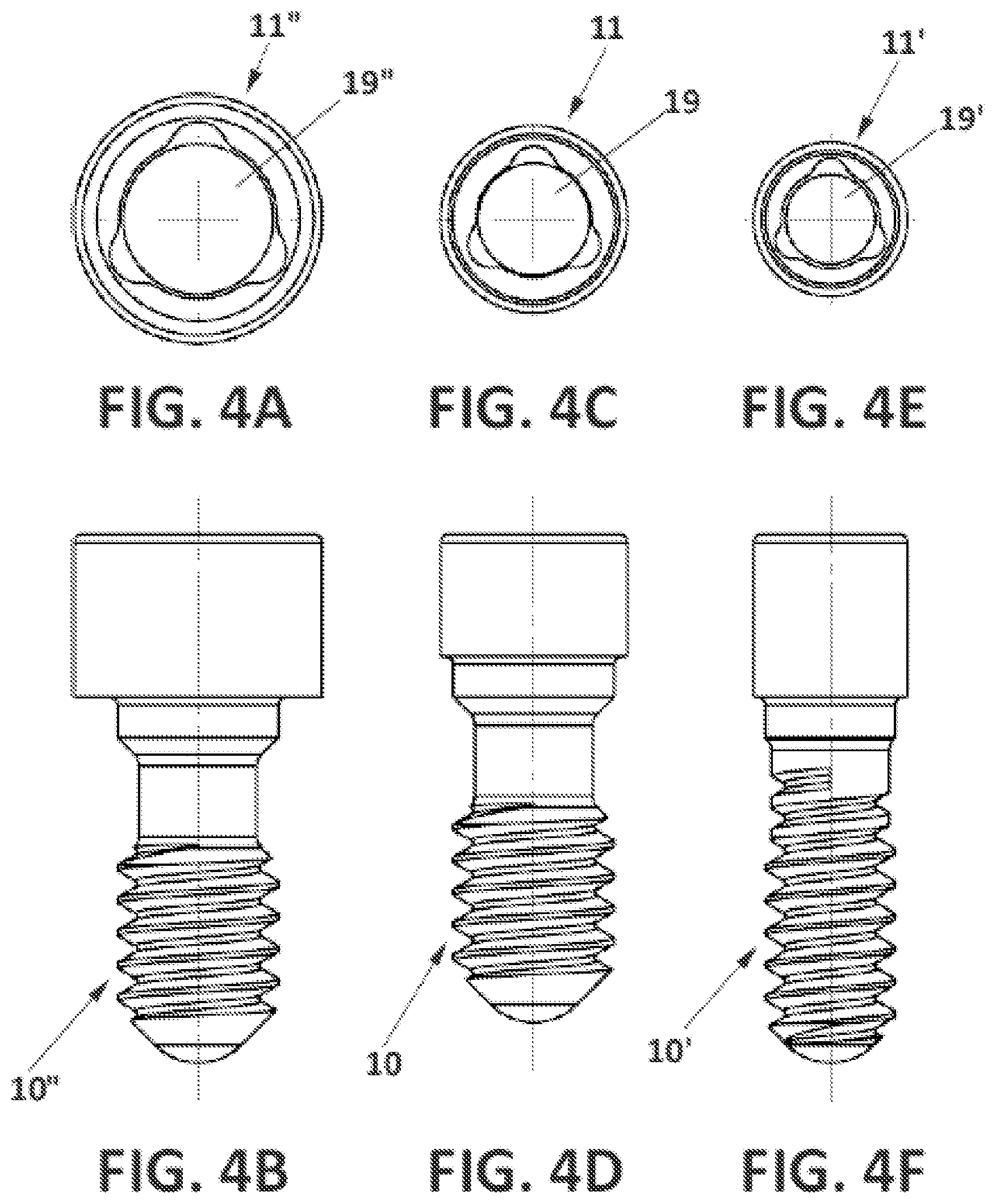 Patent US12396827 Figure 4 – Prosthetic dental screw implant, tightening tool and coupling system between the two