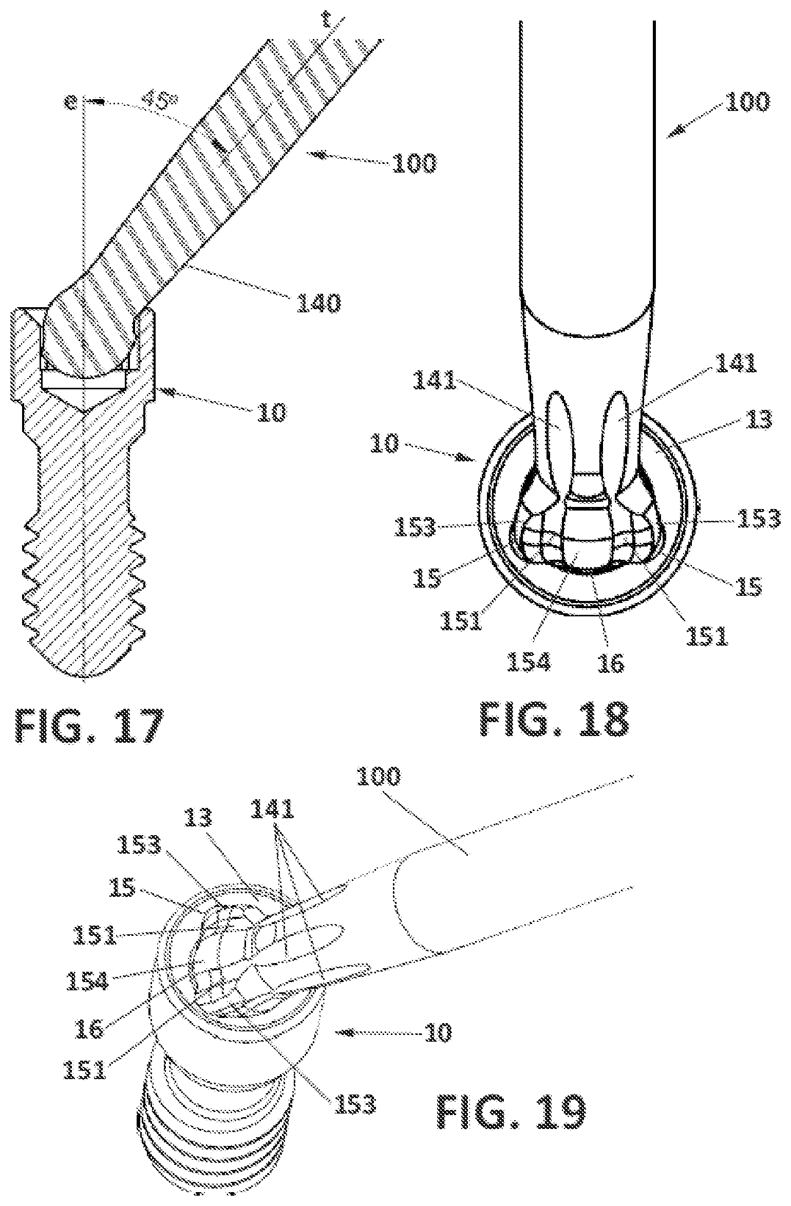 Patent US12396827 Figure 13 – Prosthetic dental screw implant, tightening tool and coupling system between the two