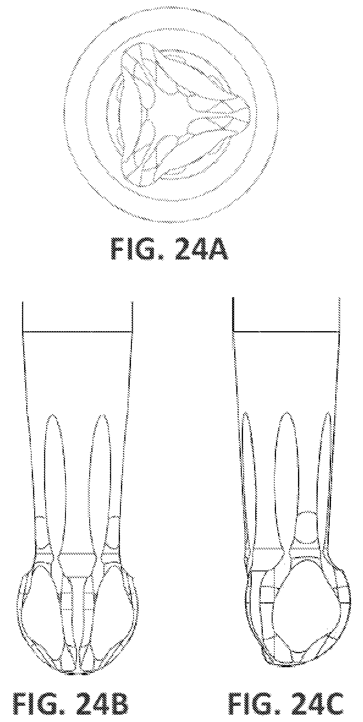 Patent US12396827 Figure 17 – Prosthetic dental screw implant, tightening tool and coupling system between the two