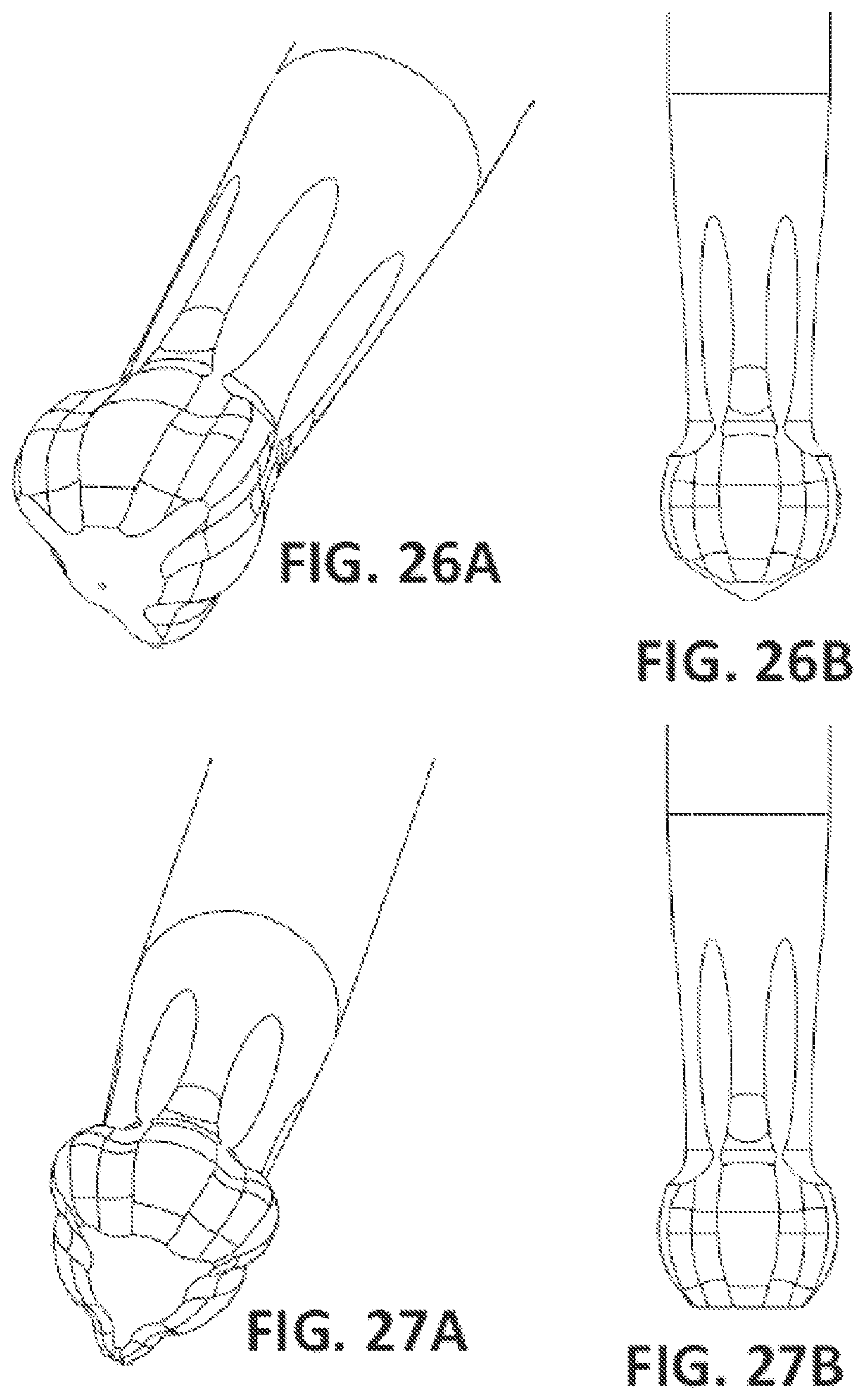 Patent US12396827 Figure 19 – Prosthetic dental screw implant, tightening tool and coupling system between the two