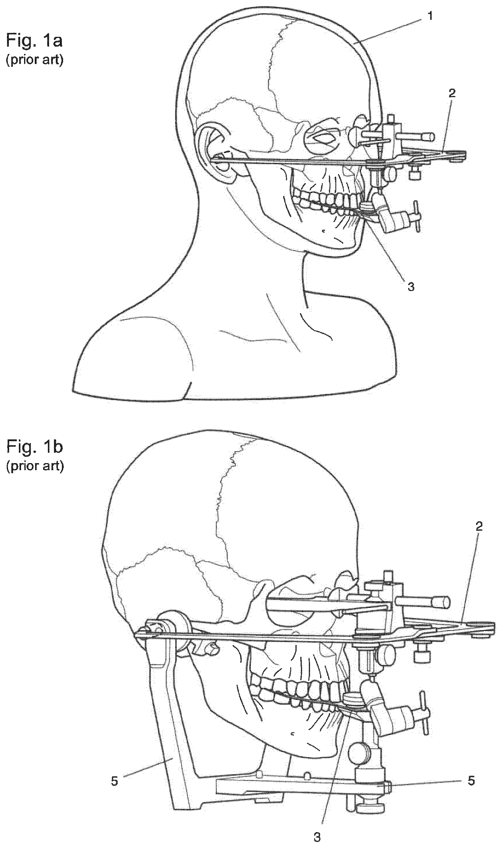 Patent US12396828 — Method for providing a 3D-print data set of a dental model structure, computer program product, dental model structure, mounting plate and dental model system — Figure 1