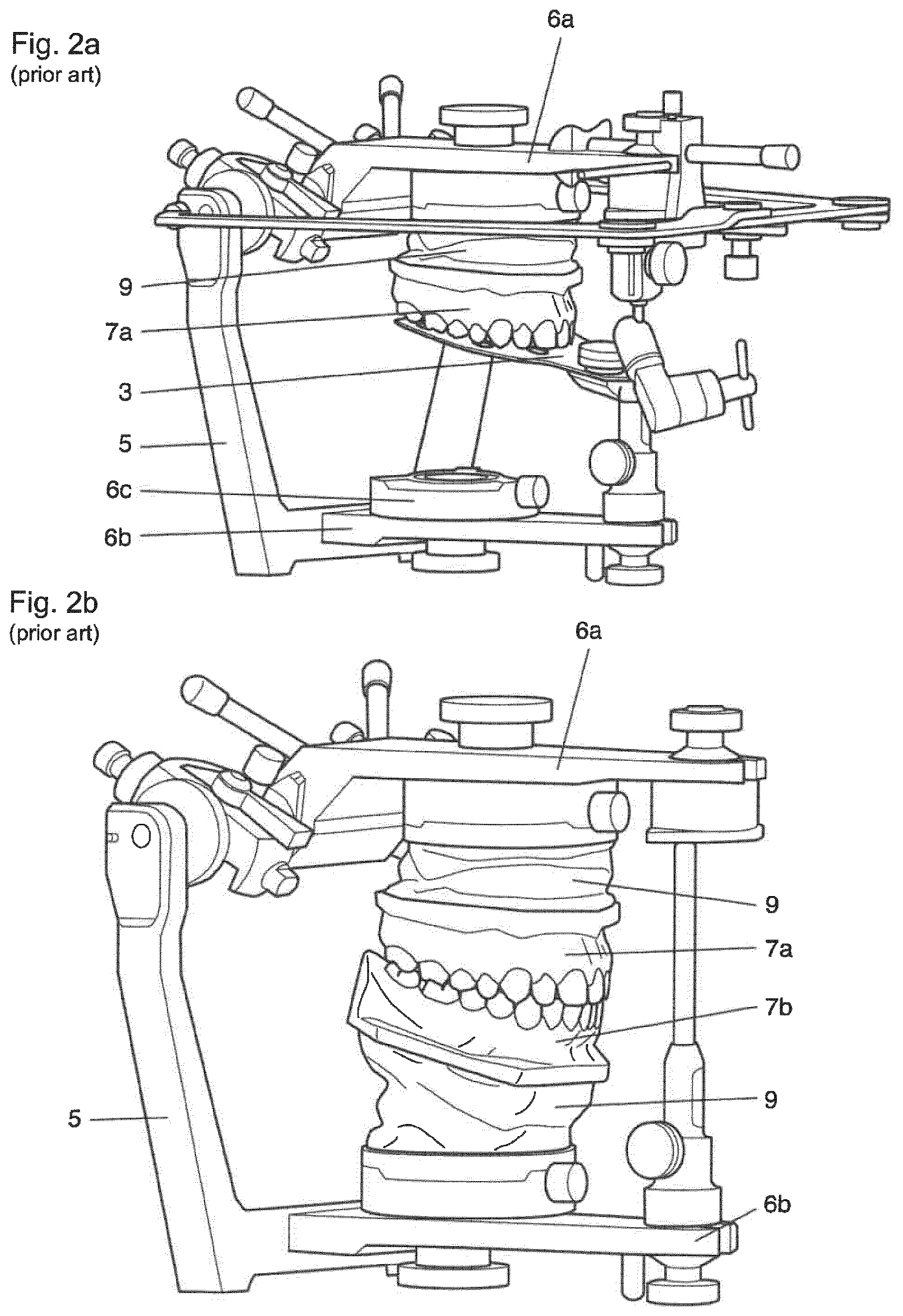 Patent US12396828 Figure 2 – Method for providing a 3D-print data set of a dental model structure, computer program product, dental model structure, mounting plate and dental model system