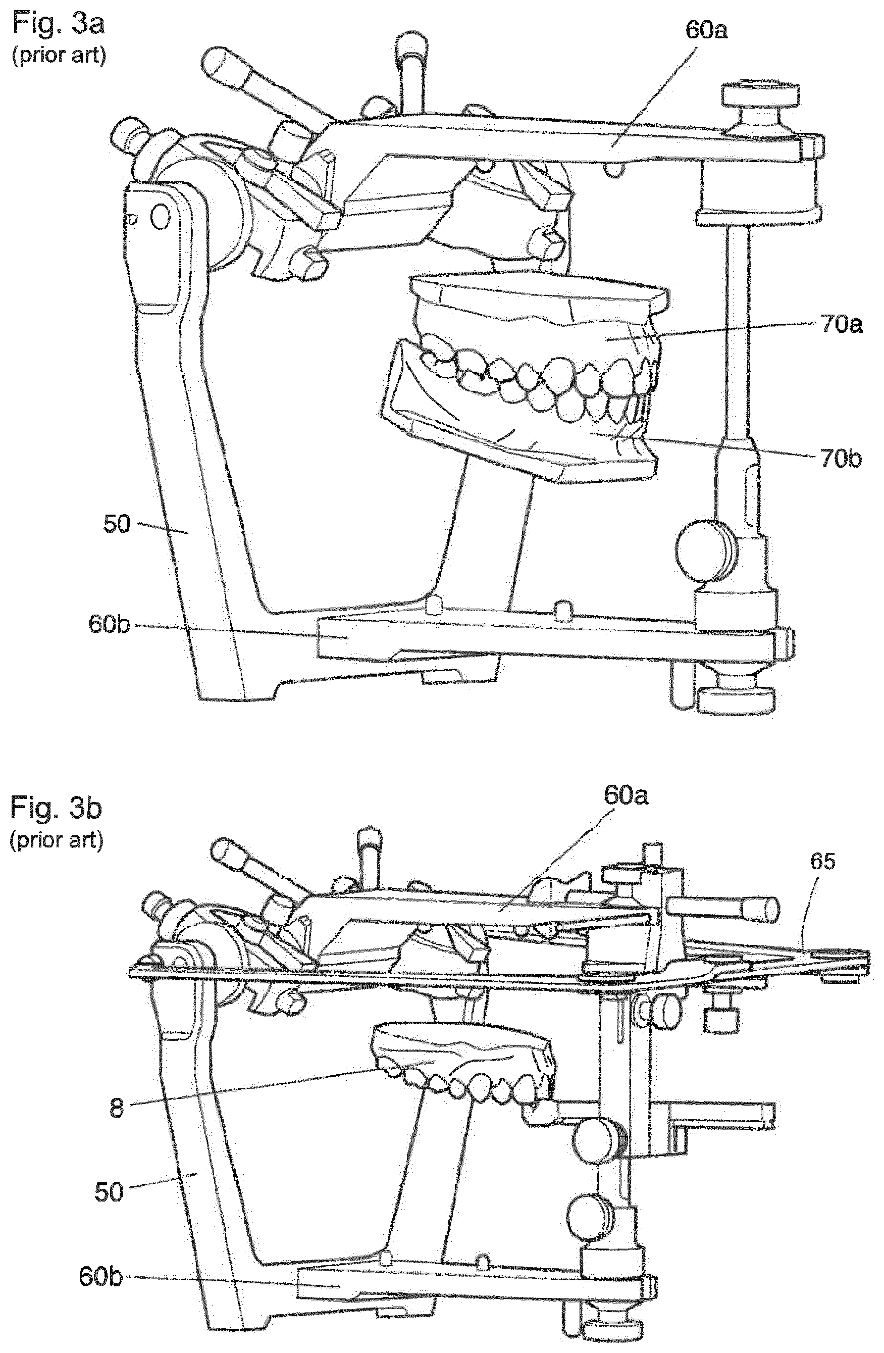 Patent US12396828 Figure 3 – Method for providing a 3D-print data set of a dental model structure, computer program product, dental model structure, mounting plate and dental model system