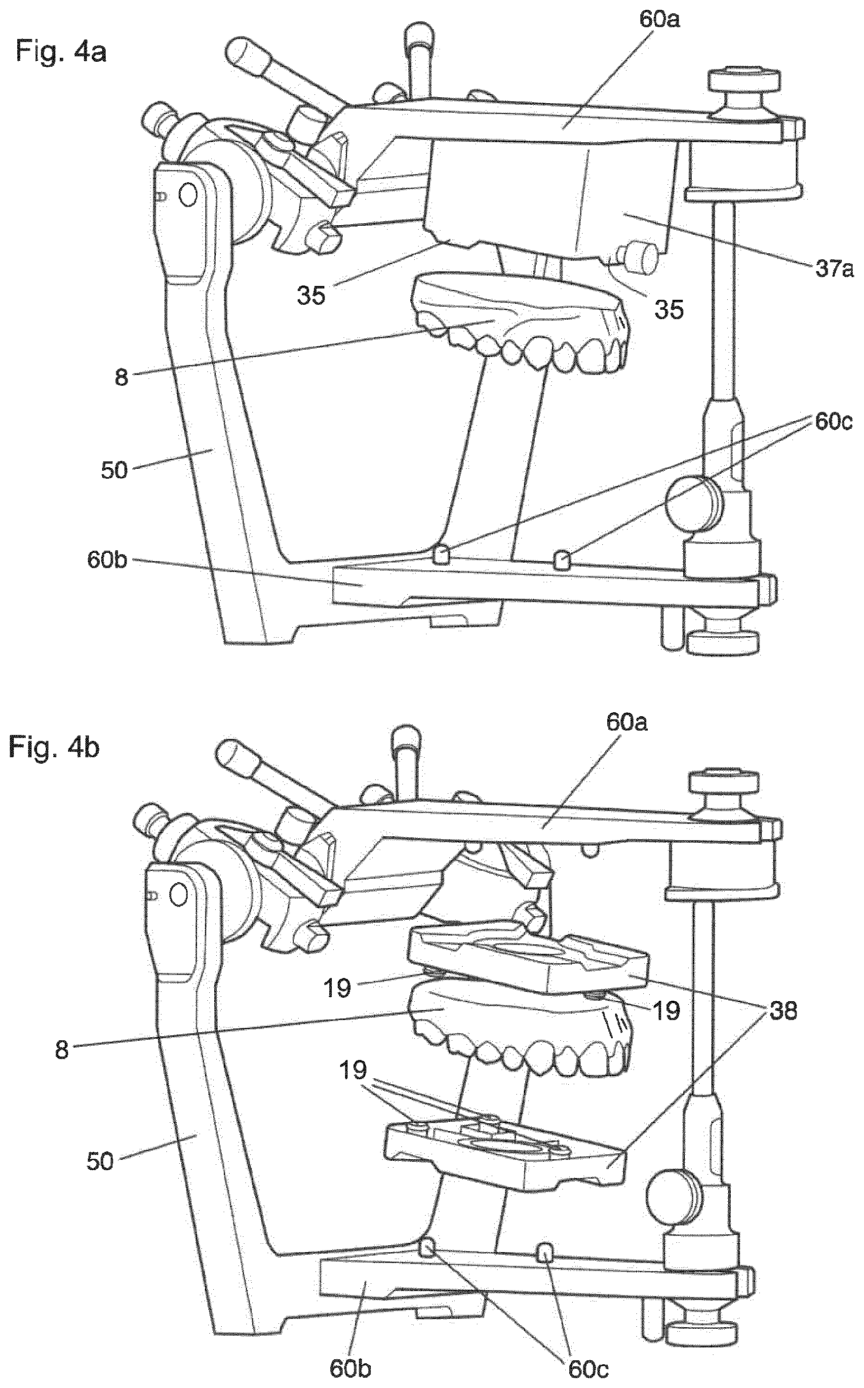 Patent US12396828 Figure 4 – Method for providing a 3D-print data set of a dental model structure, computer program product, dental model structure, mounting plate and dental model system
