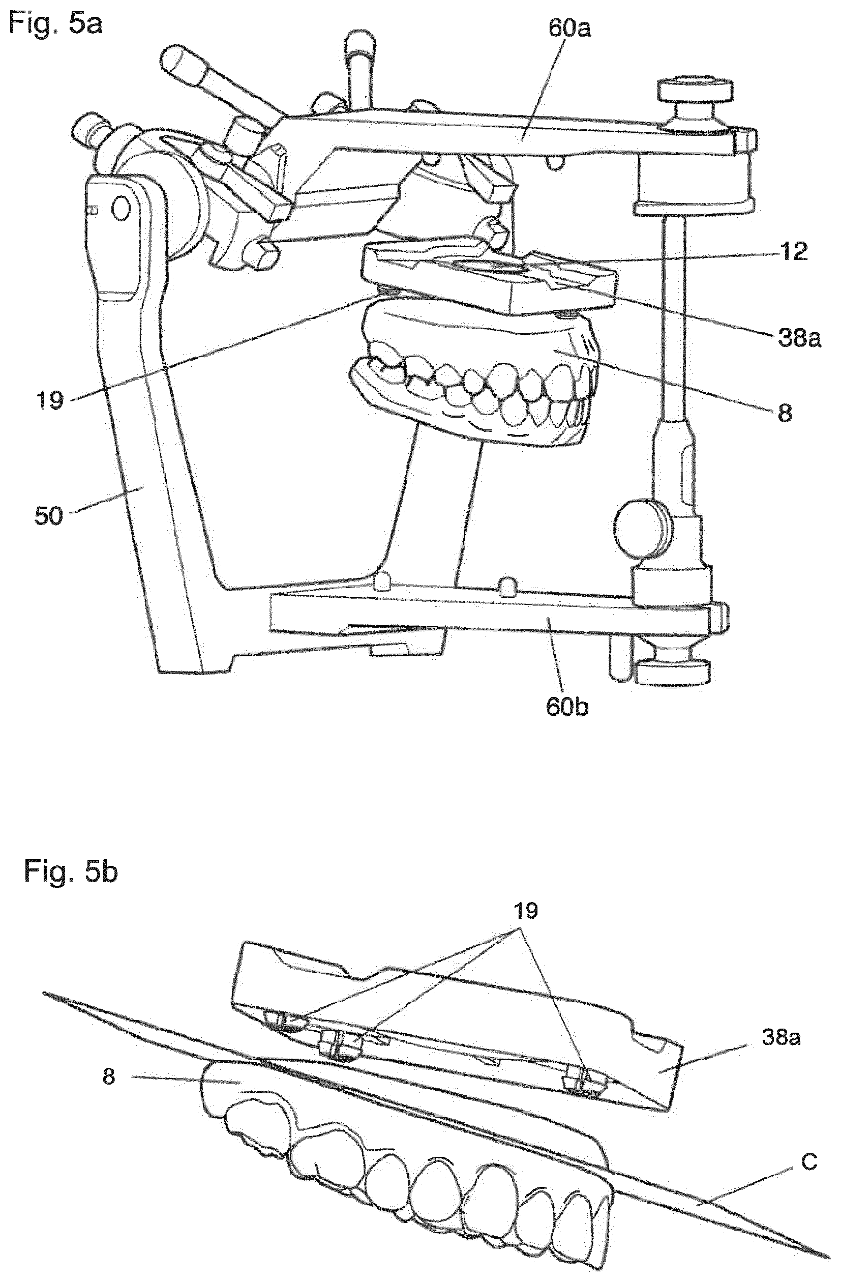 Patent US12396828 Figure 5 – Method for providing a 3D-print data set of a dental model structure, computer program product, dental model structure, mounting plate and dental model system