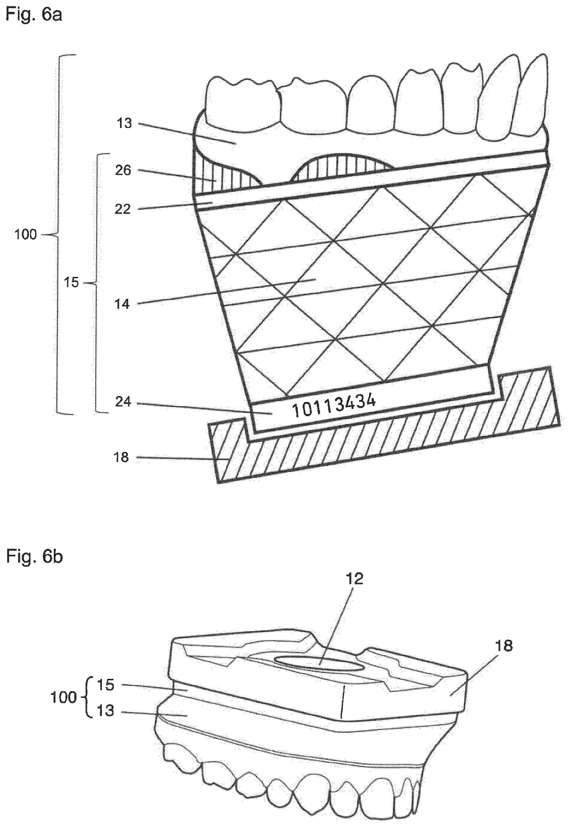 Patent US12396828 Figure 6 – Method for providing a 3D-print data set of a dental model structure, computer program product, dental model structure, mounting plate and dental model system