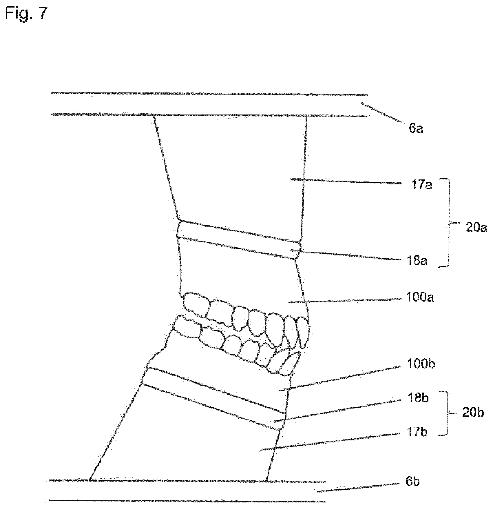 Patent US12396828 Figure 7 – Method for providing a 3D-print data set of a dental model structure, computer program product, dental model structure, mounting plate and dental model system