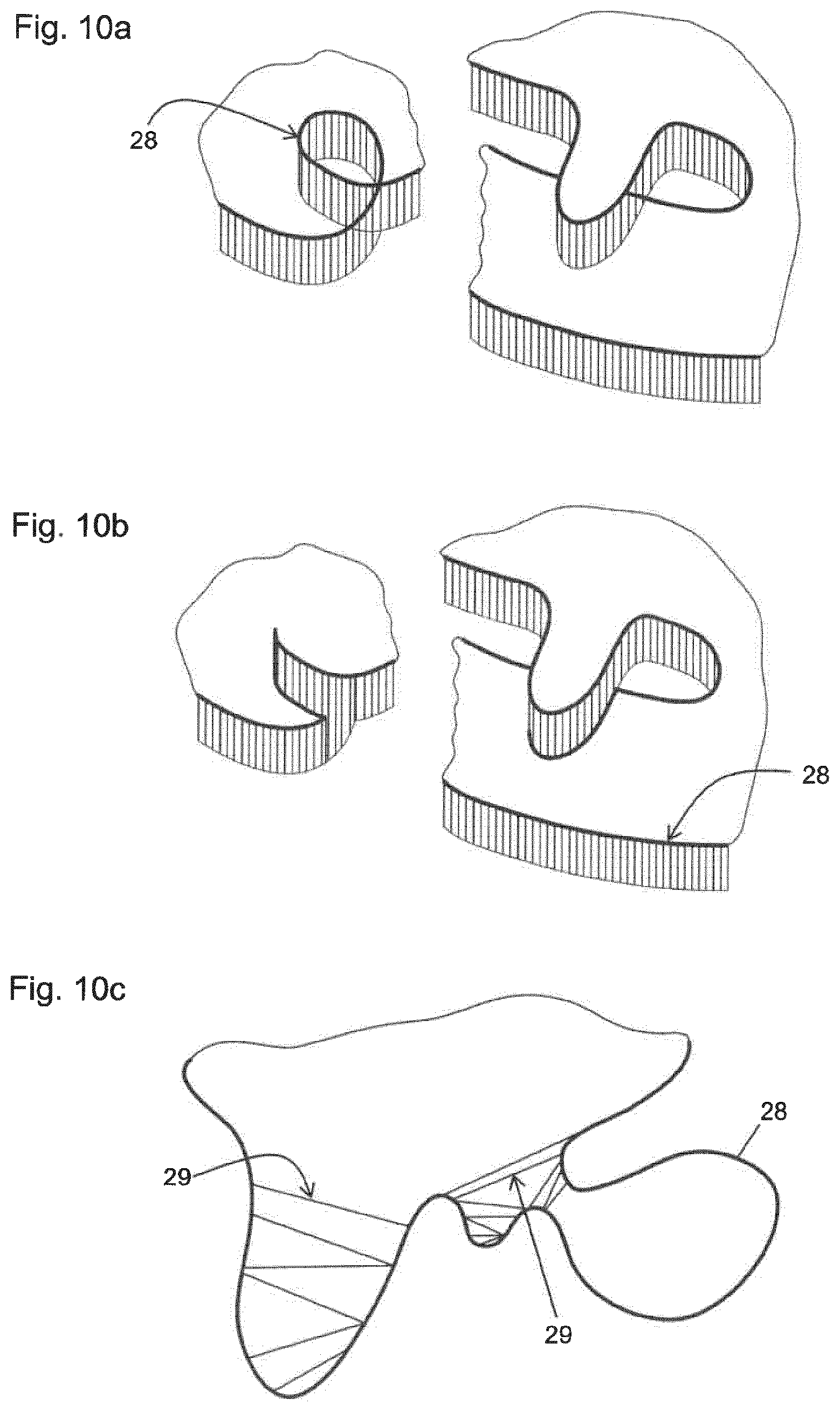 Patent US12396828 Figure 10 – Method for providing a 3D-print data set of a dental model structure, computer program product, dental model structure, mounting plate and dental model system