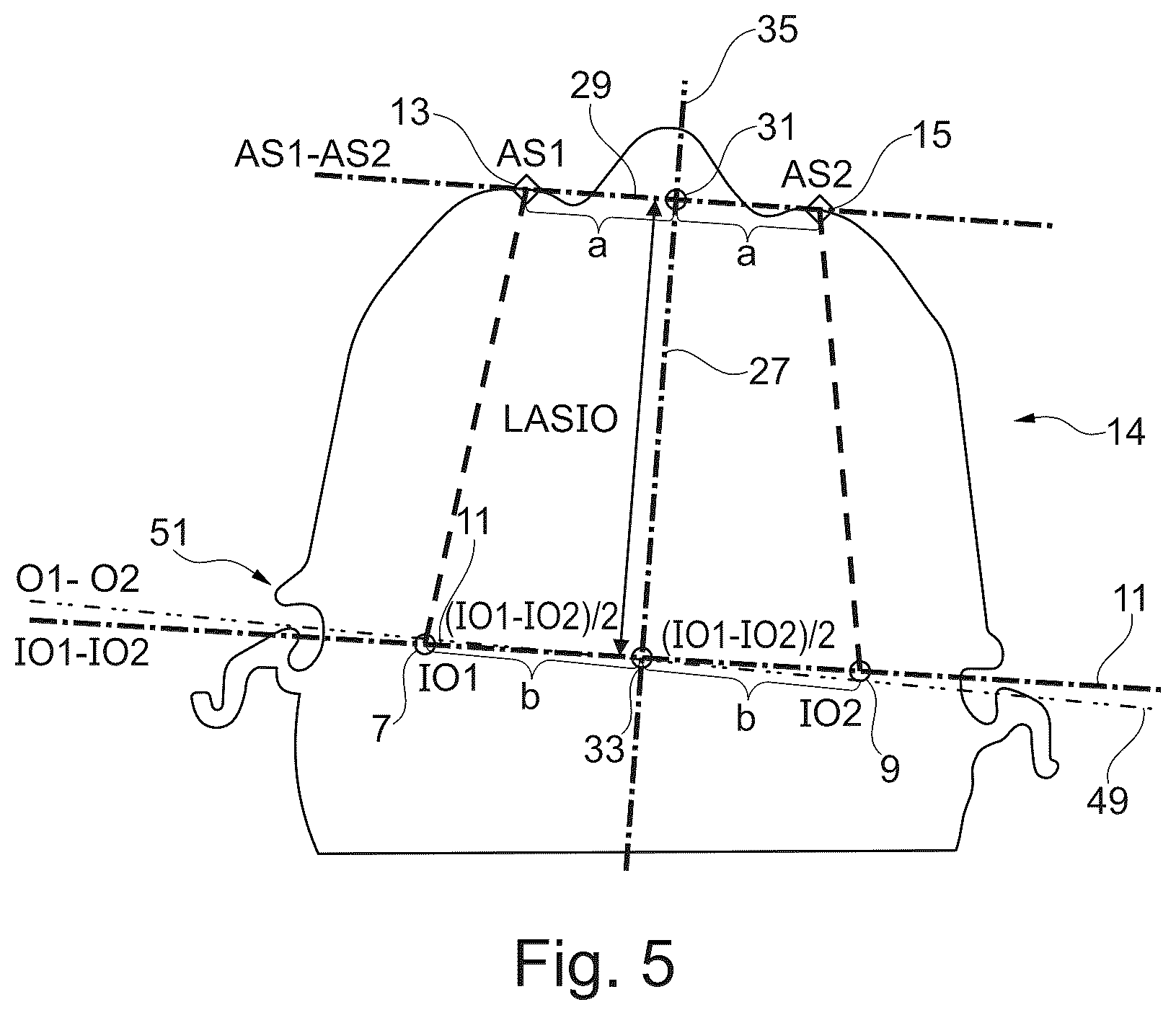 Patent US12396829 Figure 4 – Equipment for treatment of a person