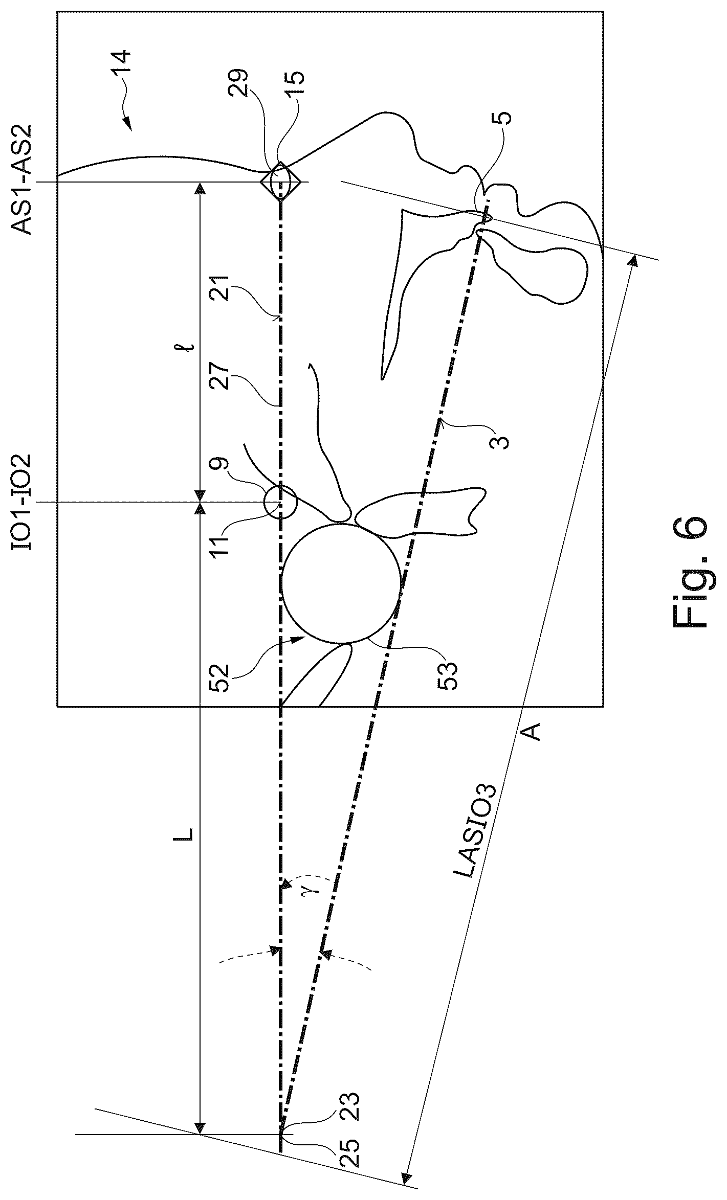 Patent US12396829 Figure 5 – Equipment for treatment of a person