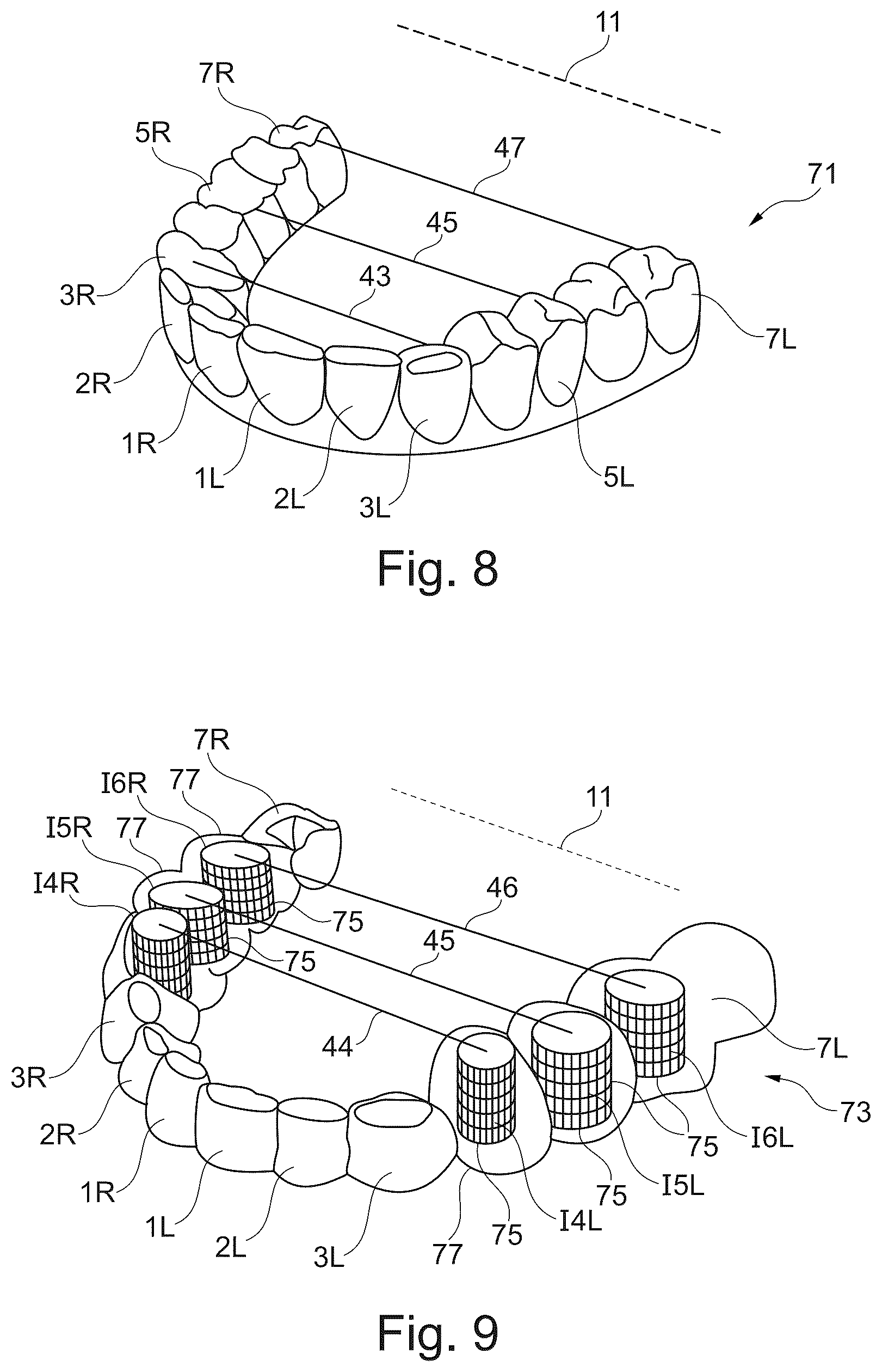 Patent US12396829 Figure 7 – Equipment for treatment of a person