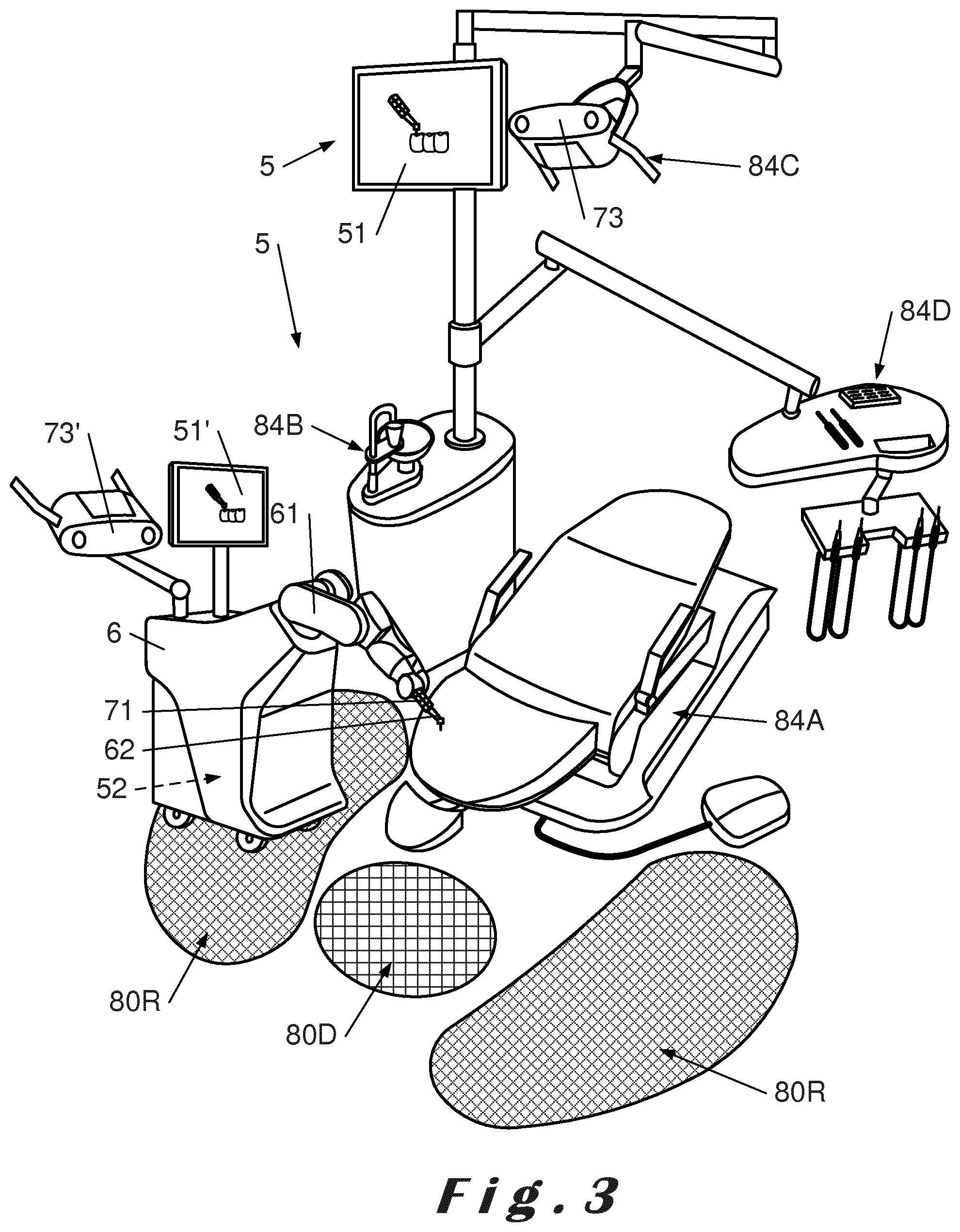 Patent US12396830 Figure 3 – Method for designing a prosthetic element