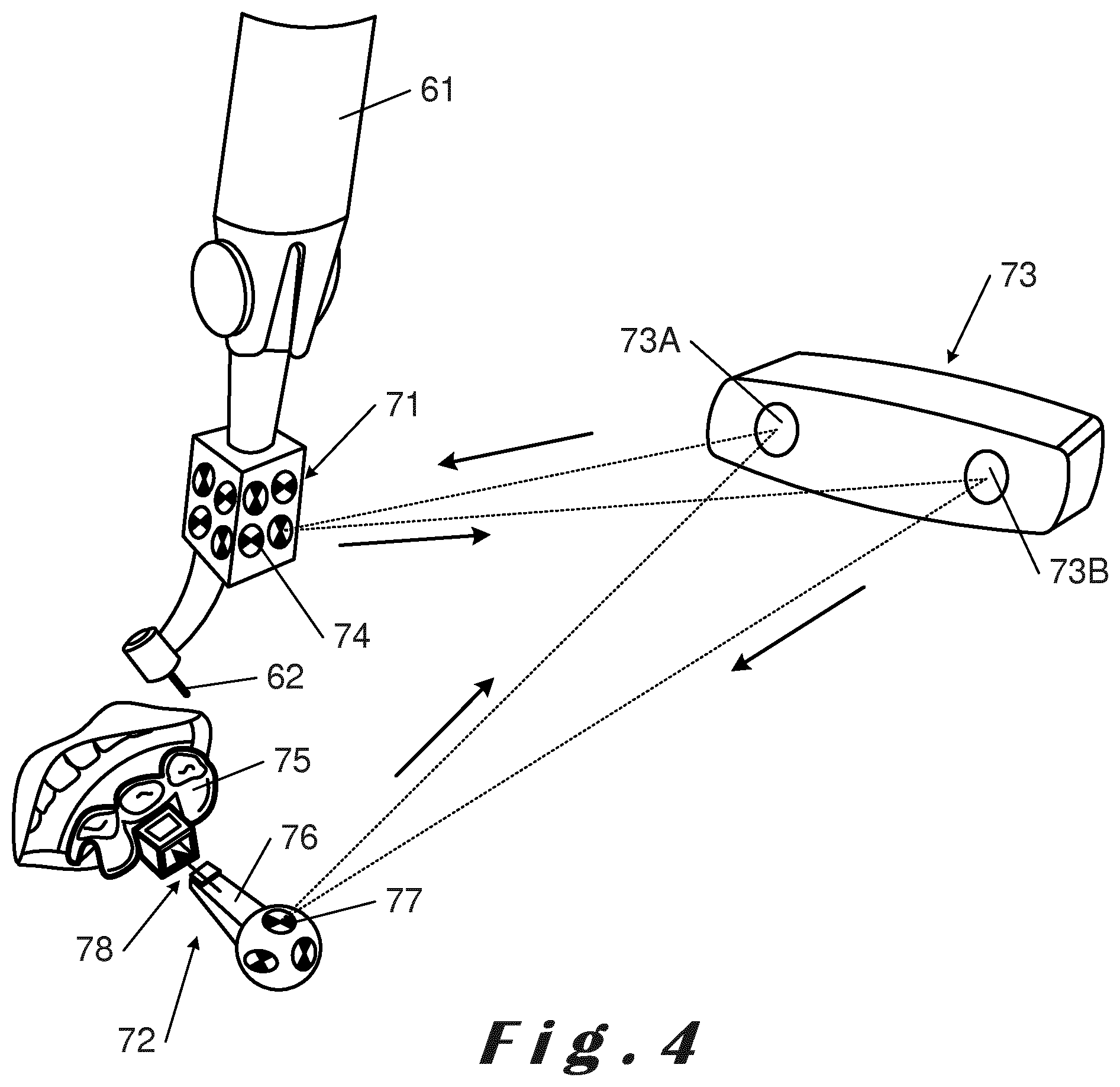 Patent US12396830 Figure 4 – Method for designing a prosthetic element